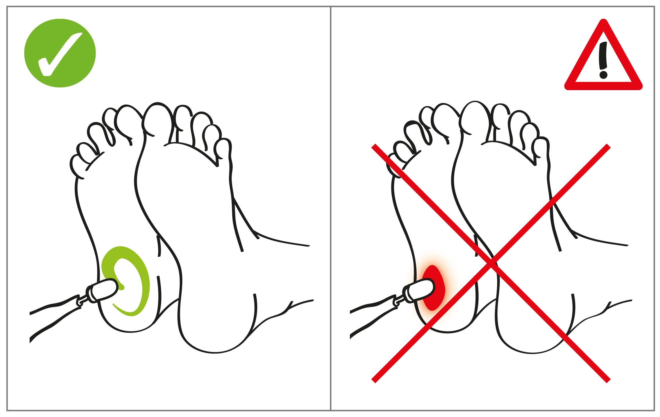 Illustration: Füße mit Schleifkappe. Links: Anwendung korrekt. Rechts: Anwendung inkorrekt, roter Bereich.