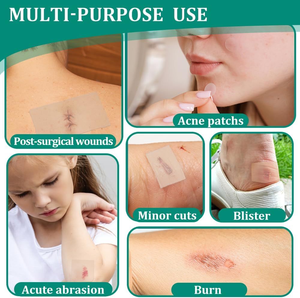 Anwendungsbeispiele für Hydrokolloid-Pflaster: Nach OP-Wunden, Akute Abschürfung, kleinere Schnitte, Verbrennung, Pickel, Blasen.