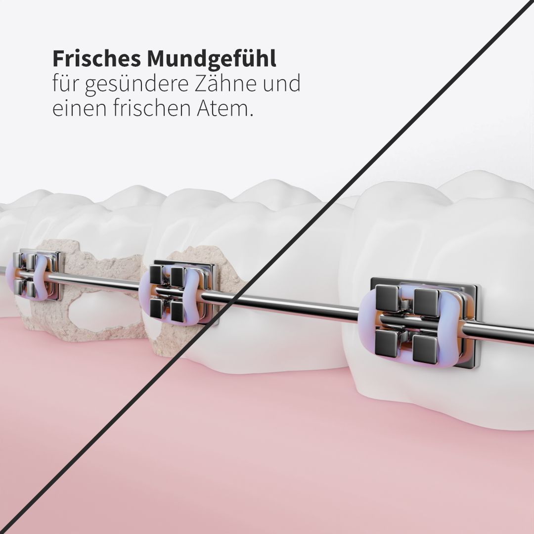 Zahnheld Ersatzdüsen Basic weiß (9 Stück)