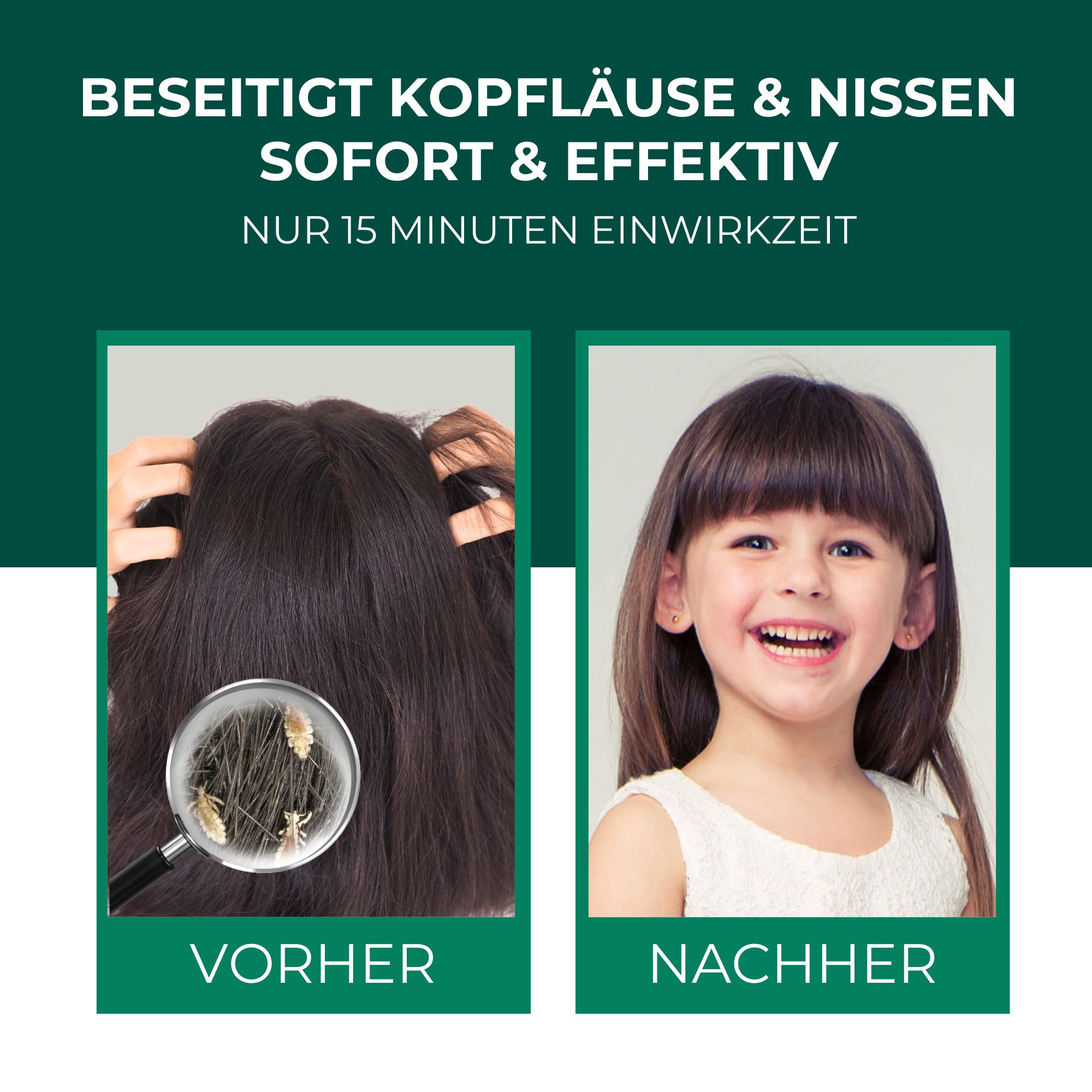 Vorher-Nachher-Vergleich: Haare mit Läusen unter Lupe, dann lächelndes Kind. Text: "Beseitigt Kopfläuse & Nissen sofort & effektiv".