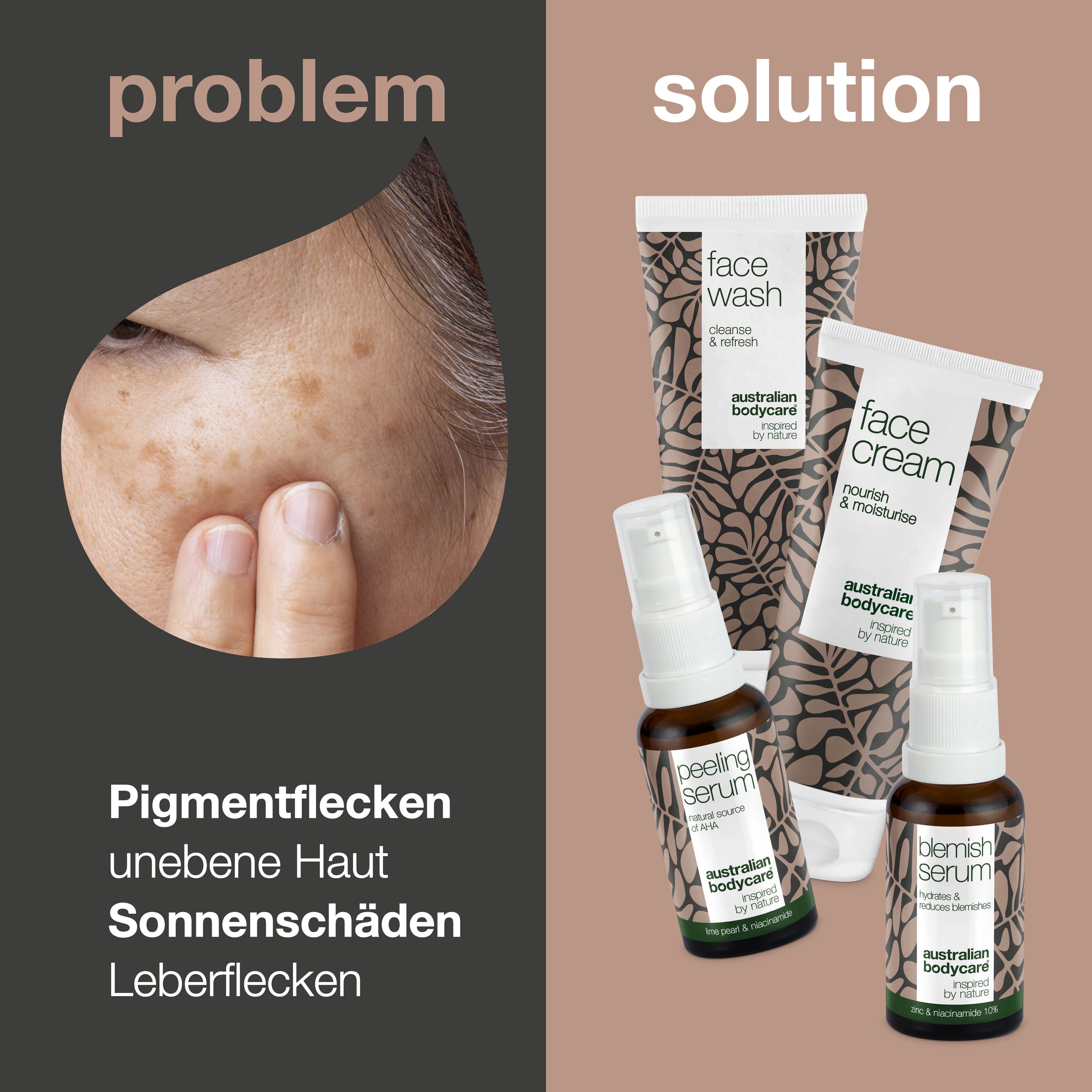Gesicht mit Pigmentflecken. Daneben die Produkte Face Wash, Face Cream, Peeling Serum und Blemish Serum.