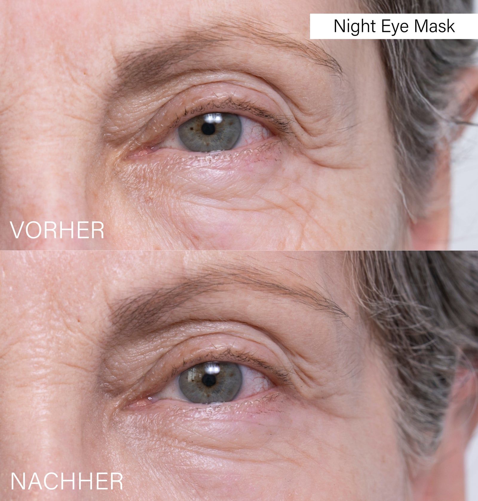 Vergleich Vorher/Nachher. Augenpartie mit Falten. Text: Vorher/Nachher. Produktname: Night Eye Mask.