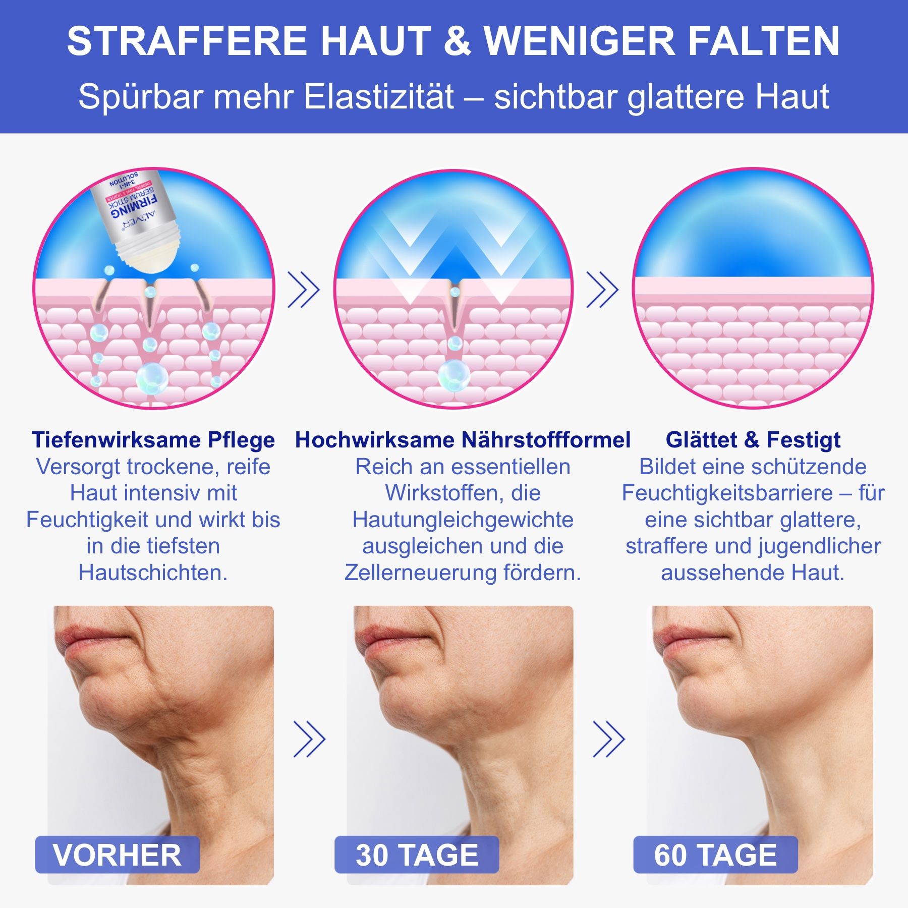 Hautveränderungen durch ALIVER Firming Serum Stick. Vorher-Nachher-Bilder. 30 Tage und 60 Tage Ergebnisse.