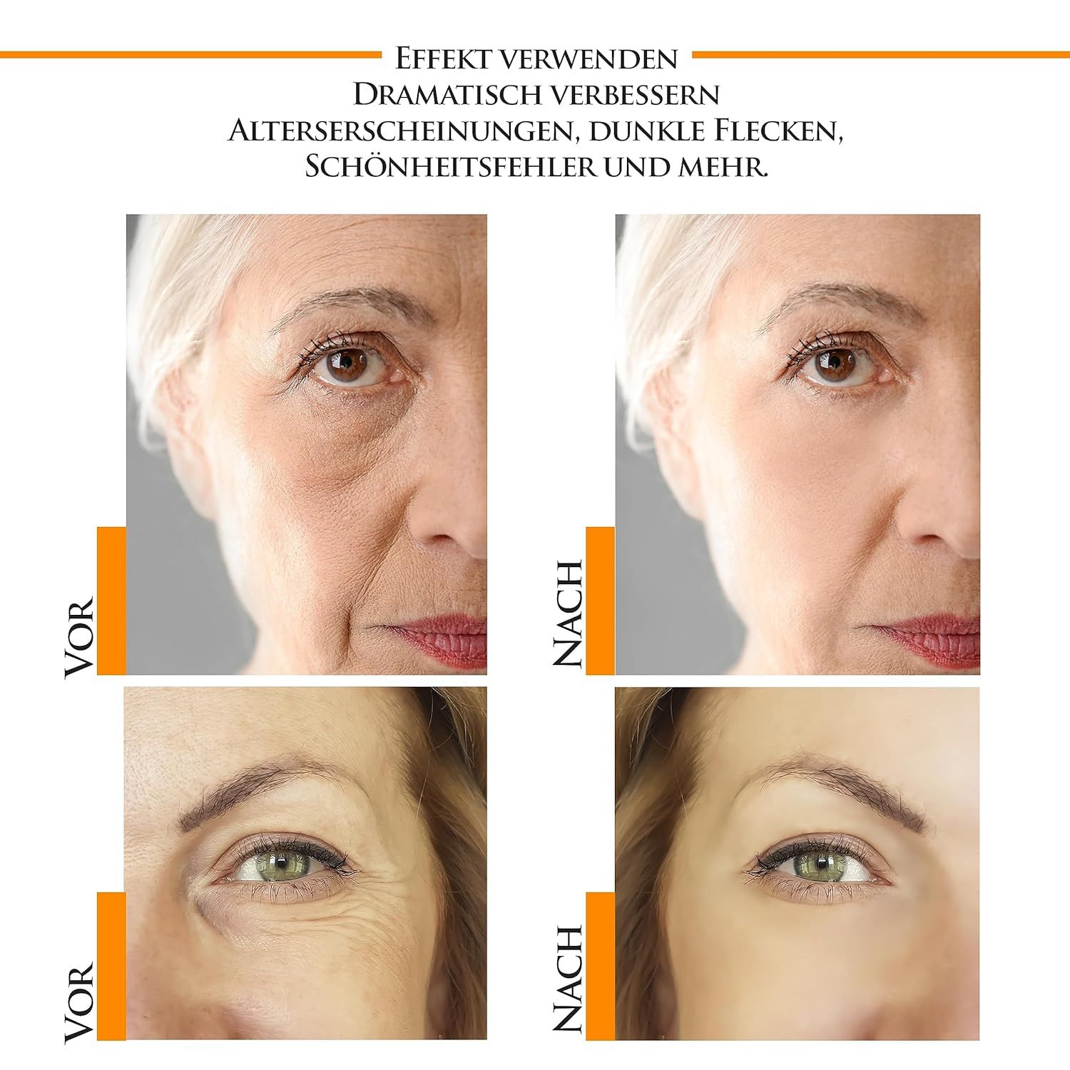 Kanzy Vitamin C Serum Gesicht