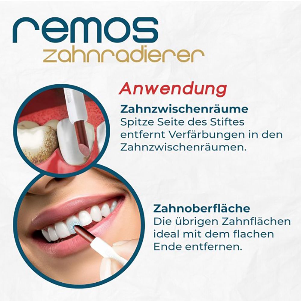 Anwendung des REMOS Zahnradierers: Spitze für Zahnzwischenräume, flaches Ende für Zahnoberflächen.