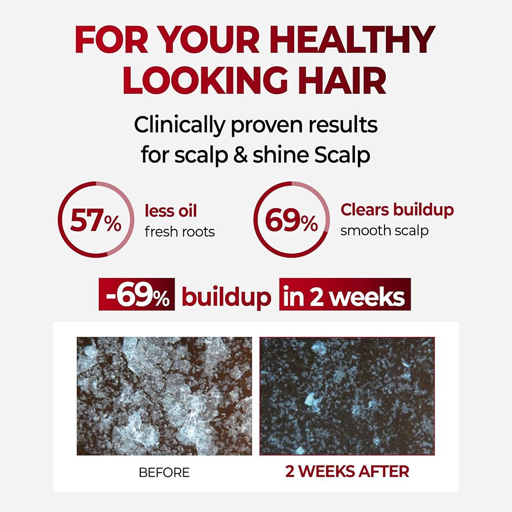 Grafik mit Ergebnissen: 57% weniger Öl, 69% weniger Ablagerungen. Vorher/Nachher-Bilder. Text: Healthy Looking Hair.