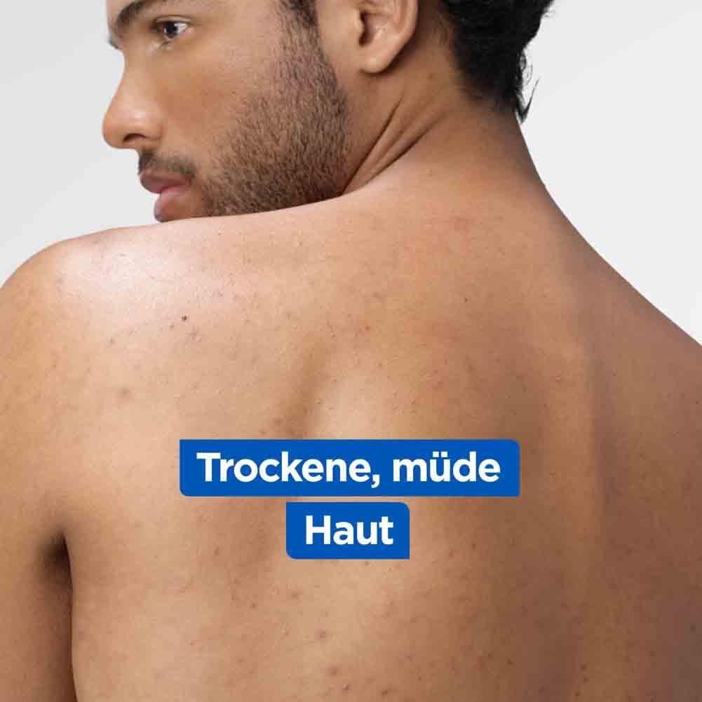 Rücken einer Person mit Text: Trockene, müde Haut.