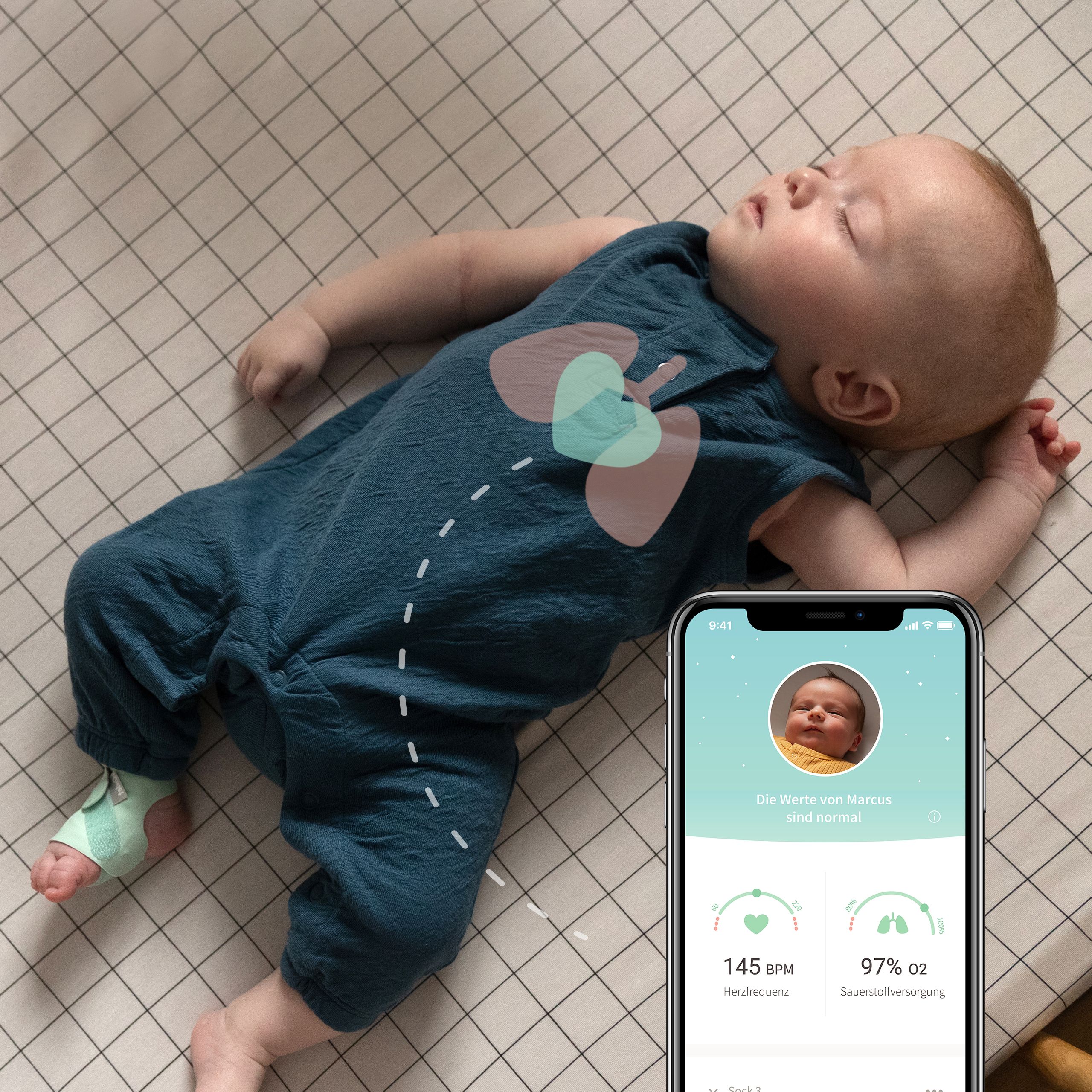 Baby schläft, Smart Sock am Fuß. Smartphone mit App-Anzeige. Baby trägt blauen Schlafanzug mit Herz-Design.