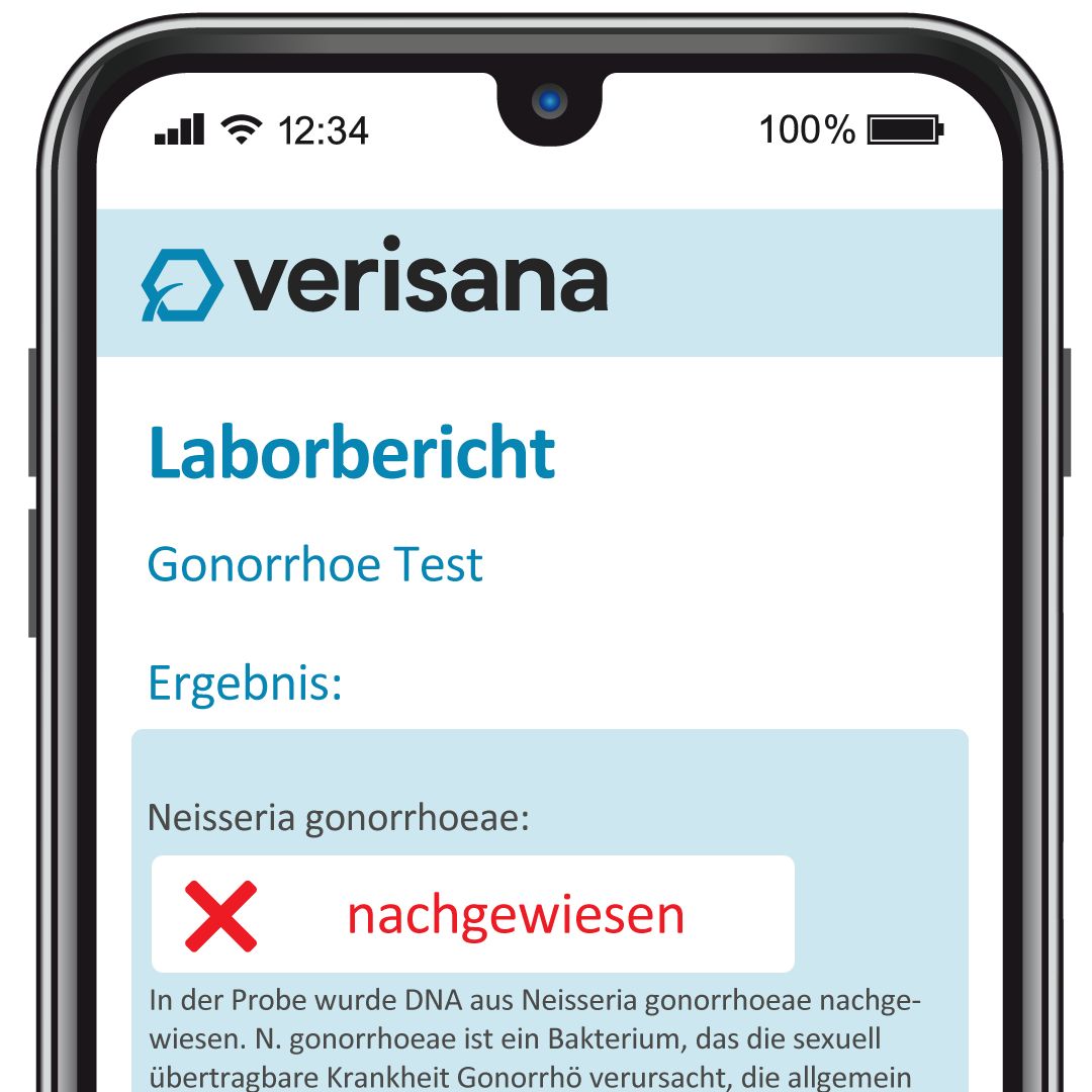 Verisana Gonorrhoe Test Mann