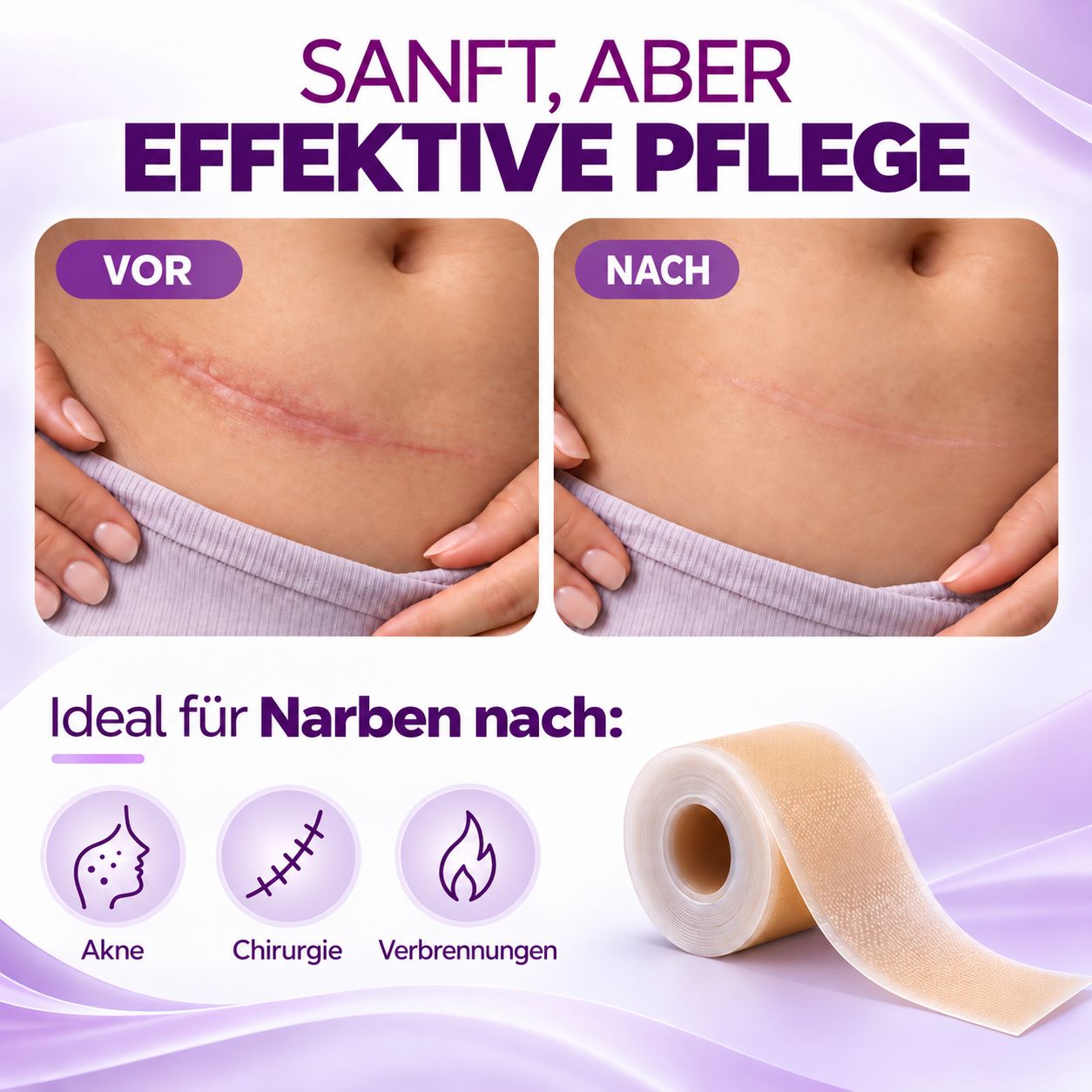 Vorher/Nachher-Vergleich von Bauch-Narben. Leiqier Narbenpflaster Rolle daneben.