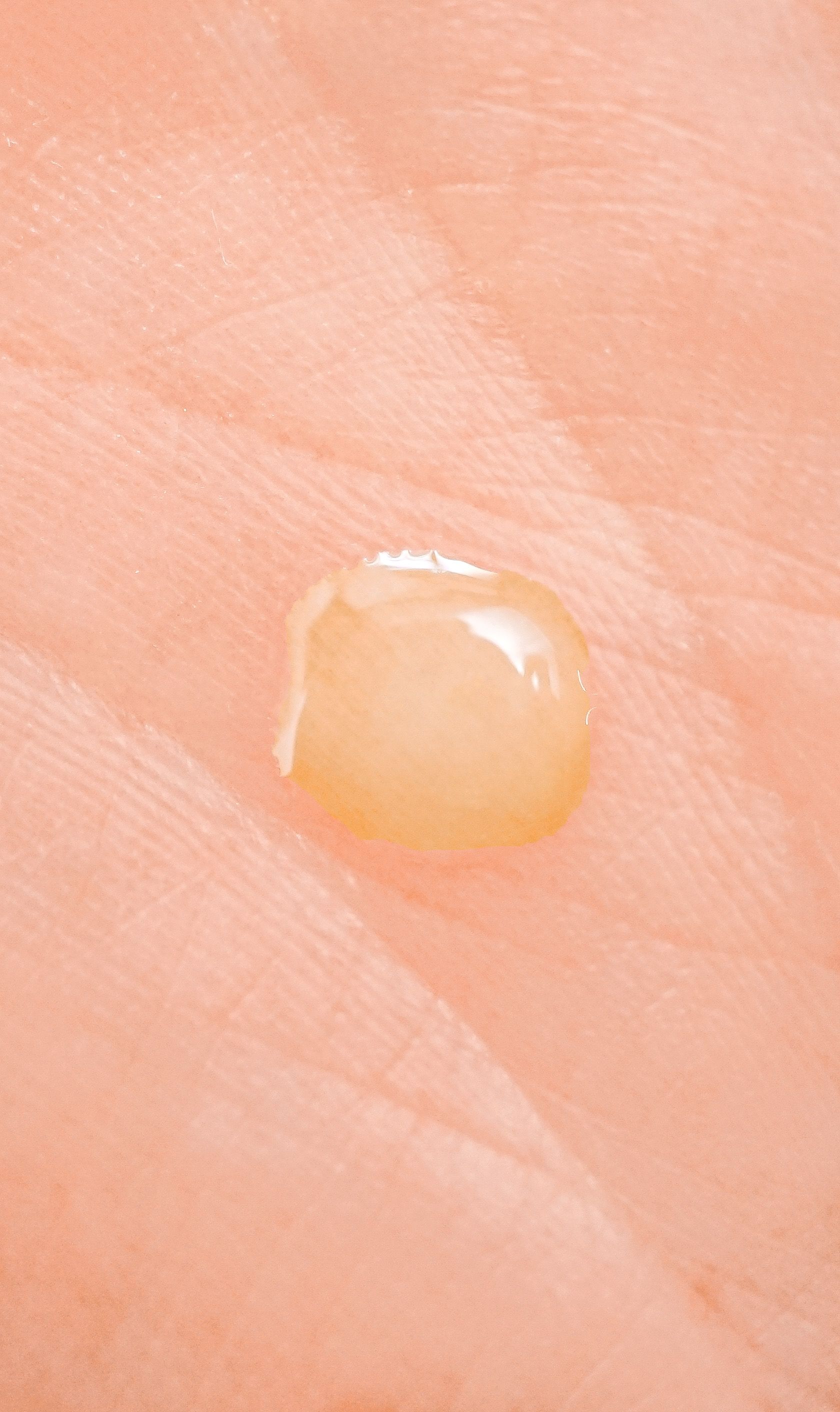 Ein Tropfen gelblicher Flüssigkeit auf einer Handfläche. Die Flüssigkeit ist leicht glänzend und hat eine unregelmäßige Form.