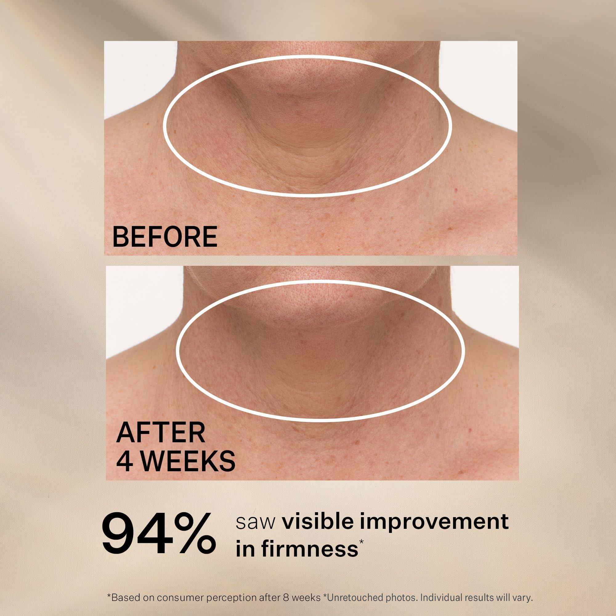 Creme-Behälter mit gelbem Deckel. Aufschrift: TL Advanced Tightening Neck Cream Plus. Marke: Strivectin.