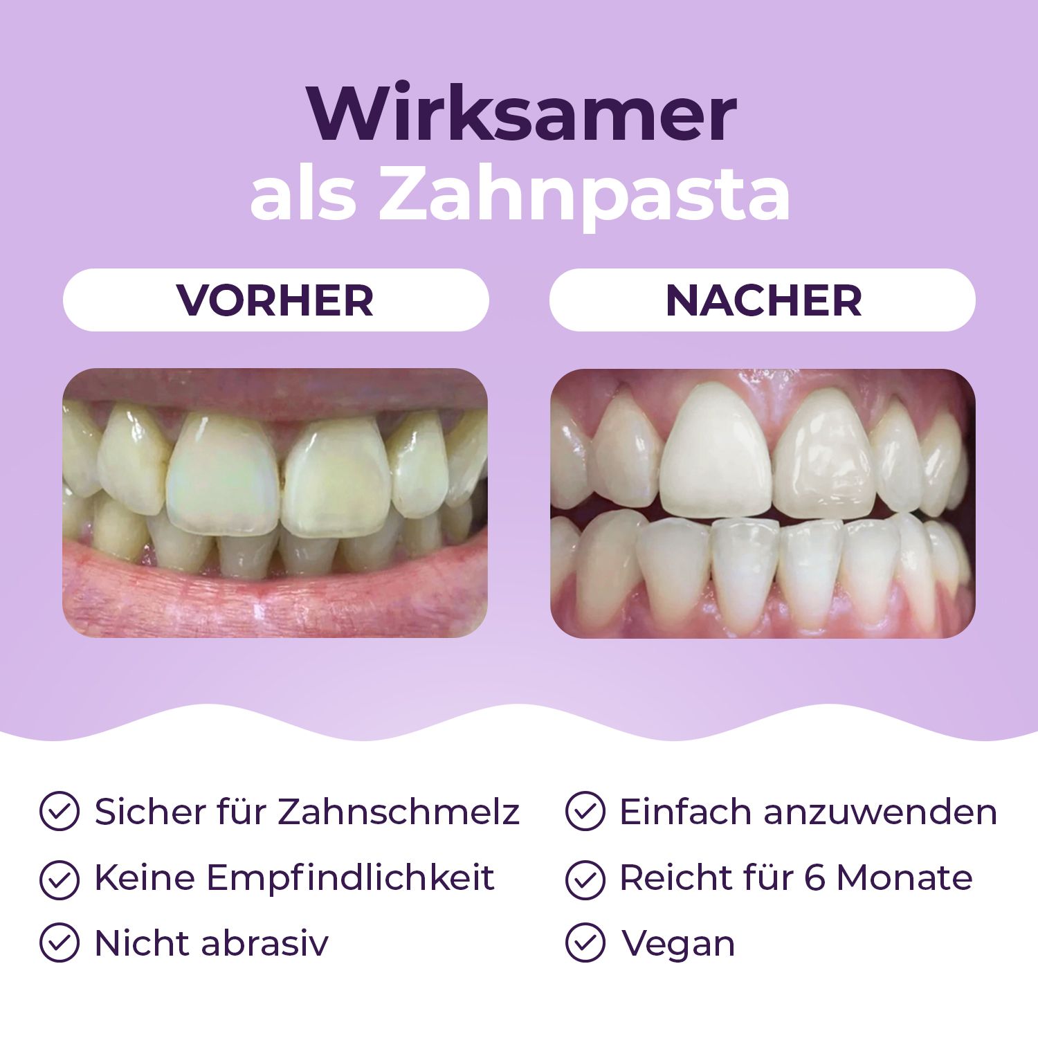 Vorher-Nachher-Vergleich von Zähnen. Text: Sicher für Zahnschmelz, keine Empfindlichkeit, nicht abrasiv.
