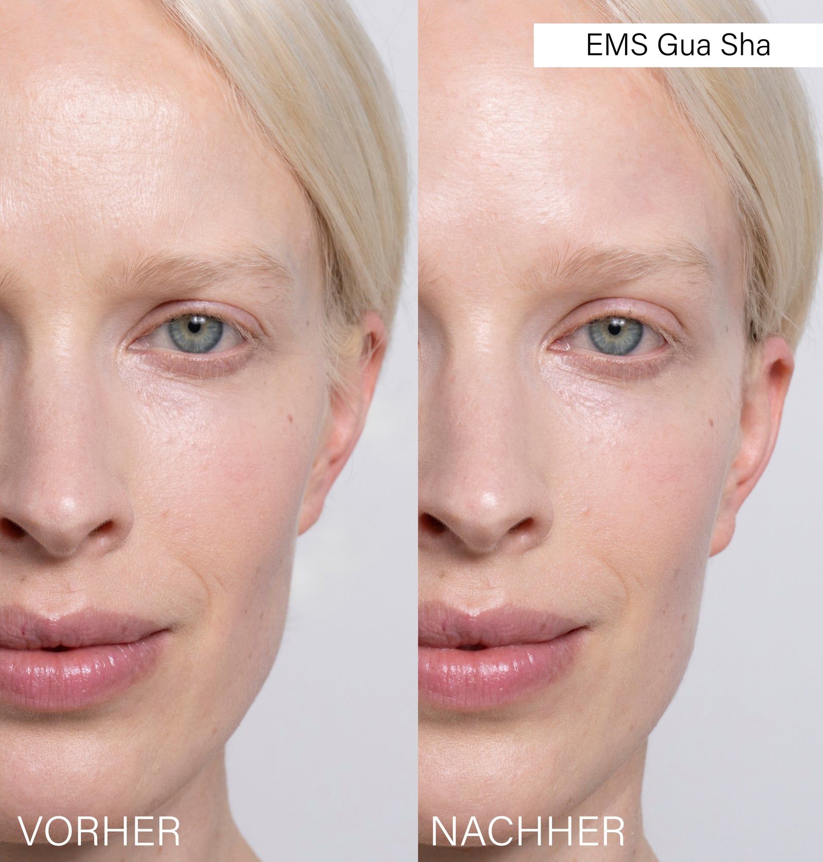 Vorher-Nachher-Vergleich zweier Gesichter. Oben steht "EMS Gua Sha". Links: Gesicht. Rechts: Gesicht.