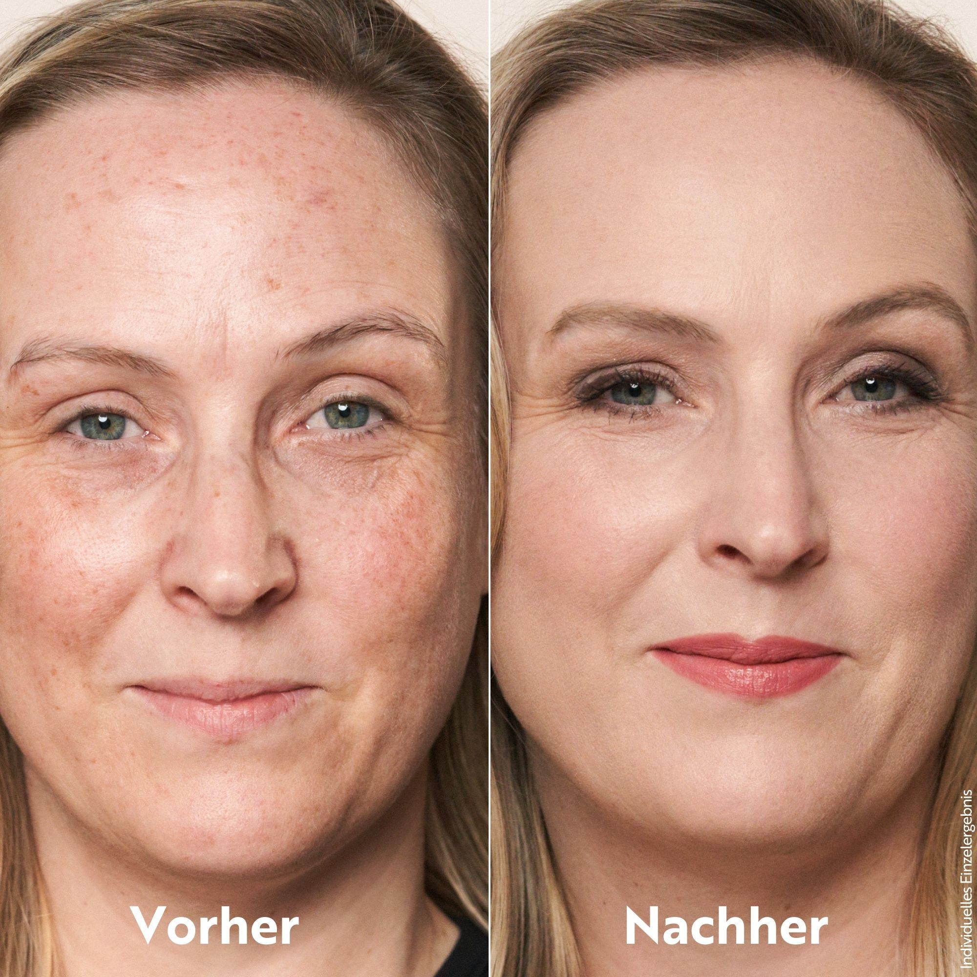 Vorher-Nachher-Vergleich. Eine Frau mit ungeschminktem Gesicht und eine Frau mit geschminktem Gesicht. Der Concealer ist aufgetragen.