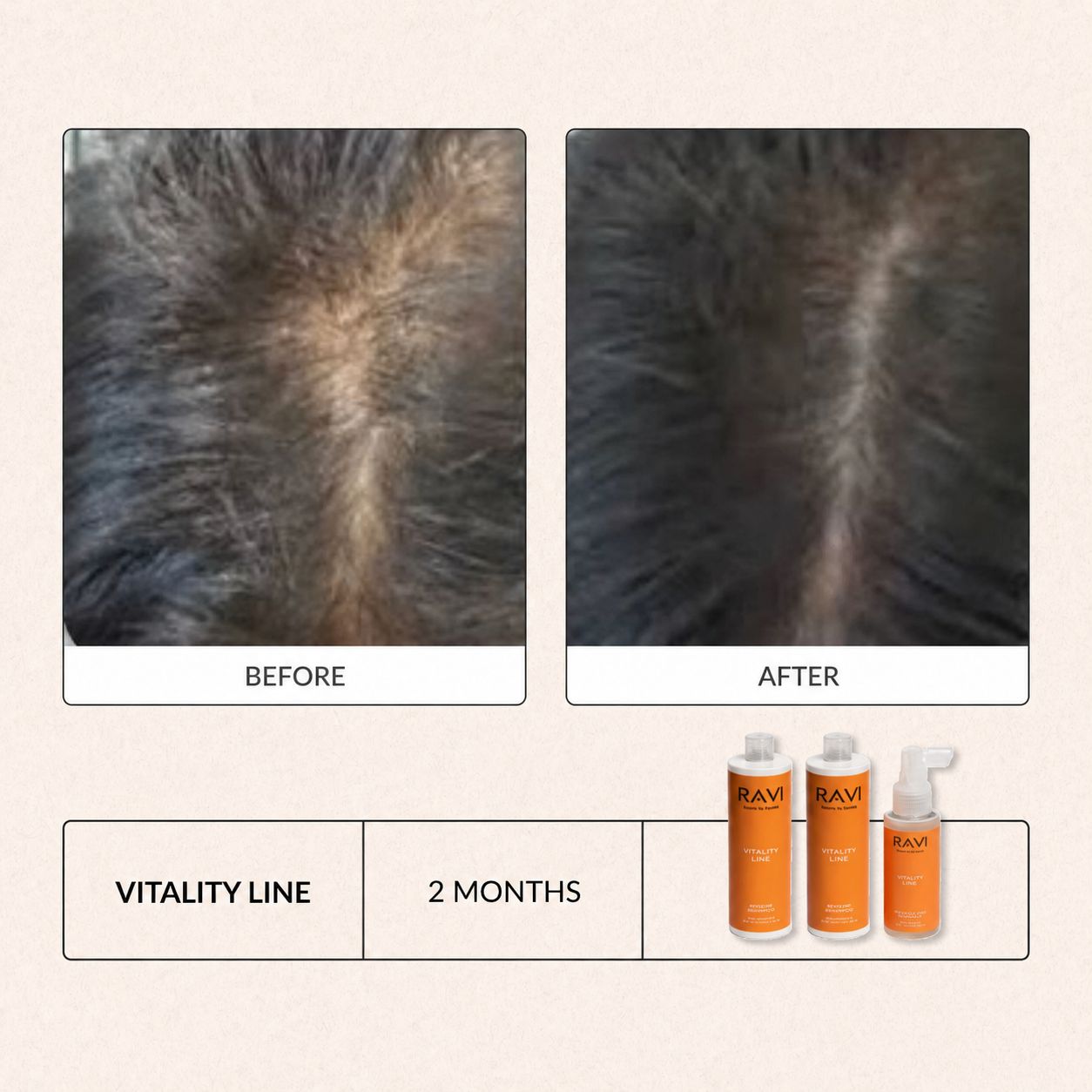 Vorher-Nachher-Vergleich von Haaren nach 2 Monaten mit RAVI Vitality Line.