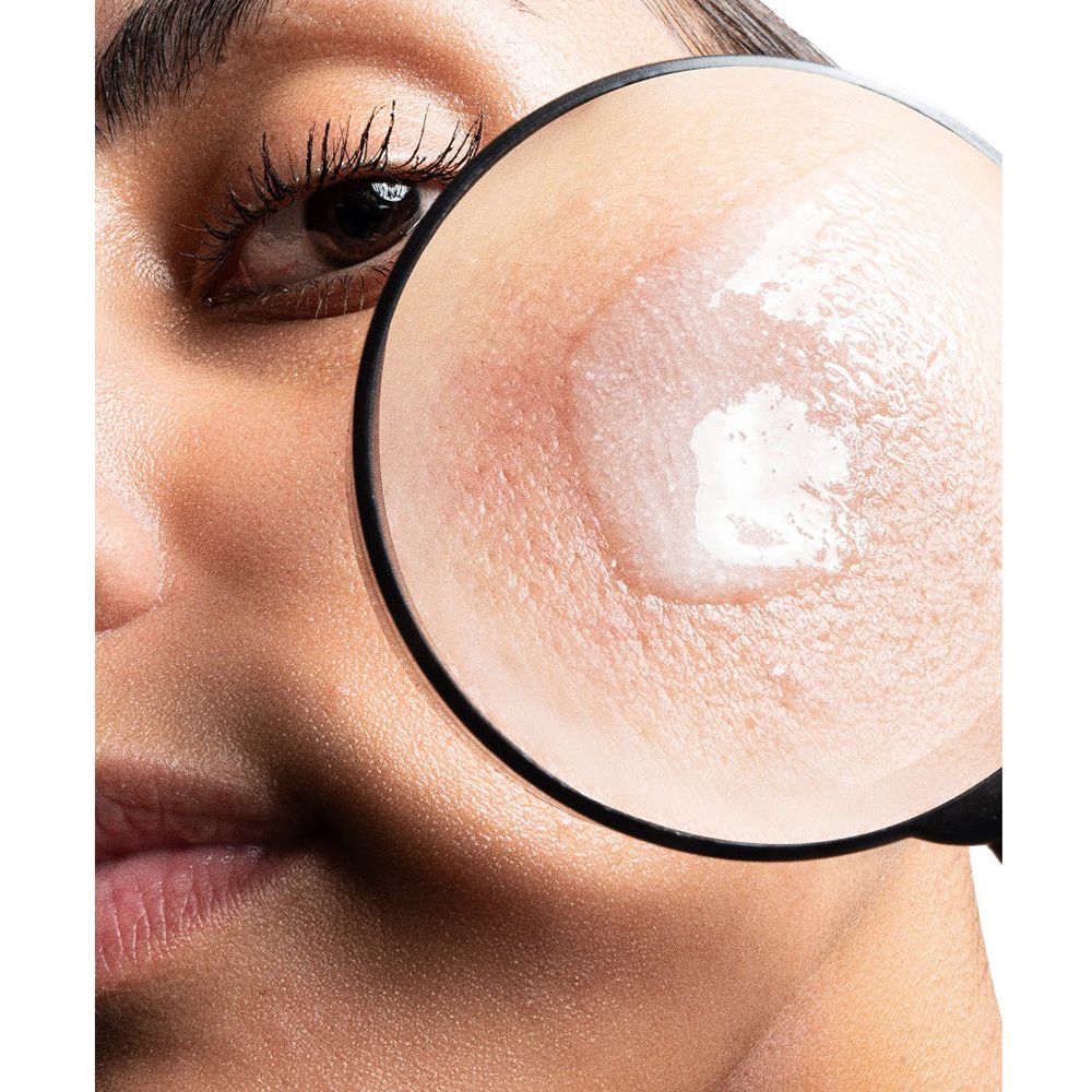 Nahaufnahme eines Gesichts mit vergrößerter Hautpartie. Serum auf der Haut. Vergrößerungsglas.