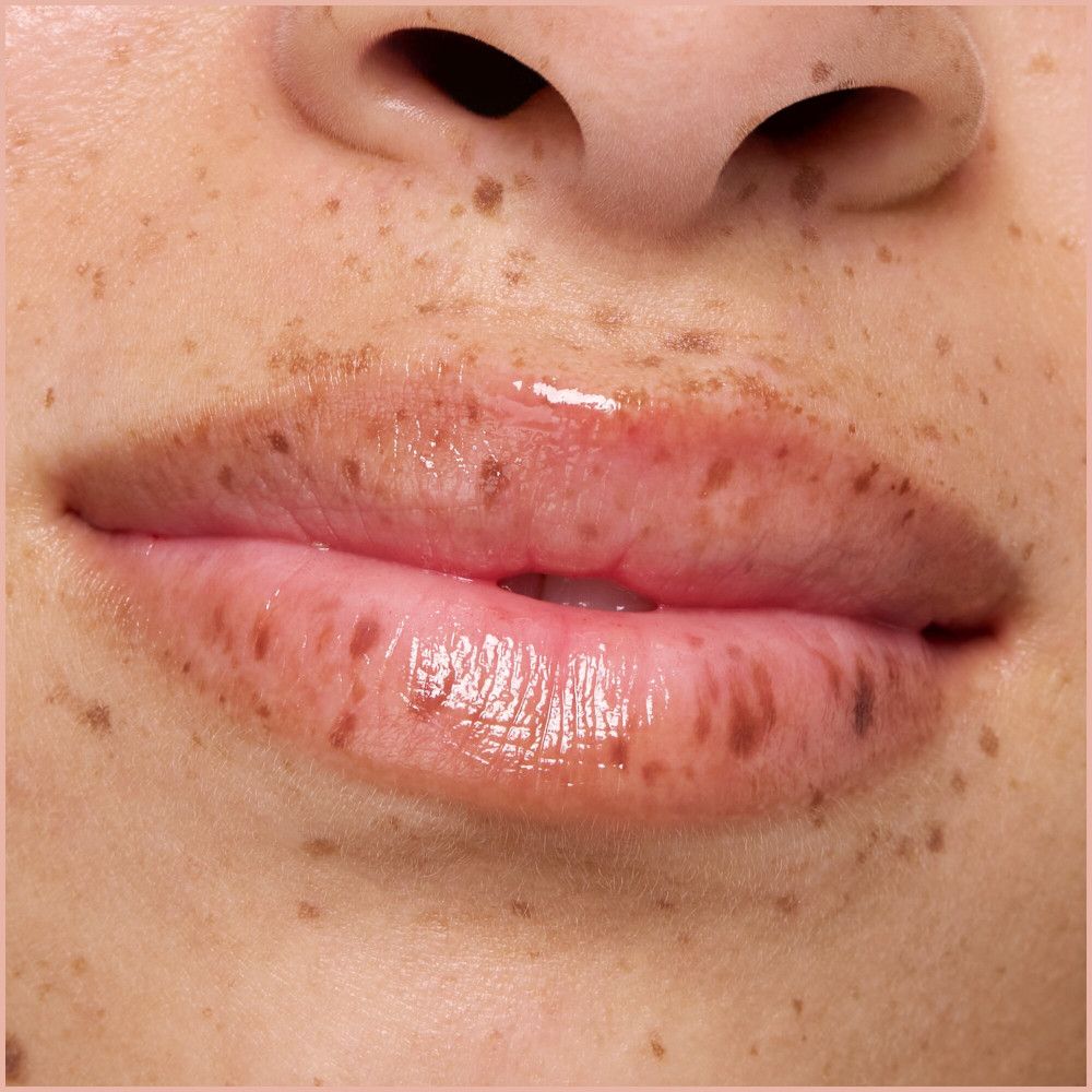 Nahaufnahme von Lippen mit Lippenbalsam. Haut mit Sommersprossen.