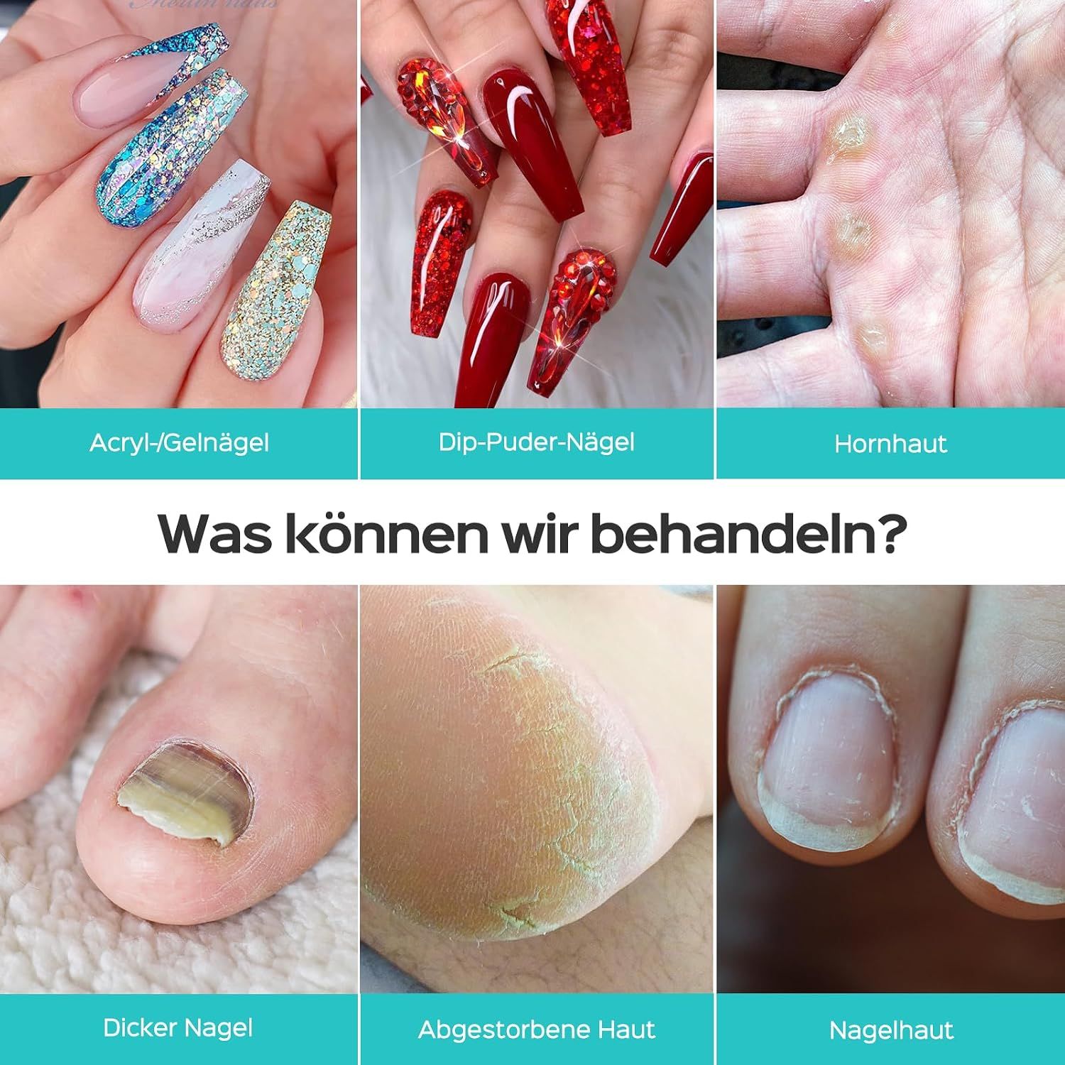 Beispiele für behandelbare Nagelprobleme: Acryl-/Gelnägel, Dip-Pulver-Nägel, Hornhaut, dicker Nagel, abgestorbene Haut, Nagelhaut.