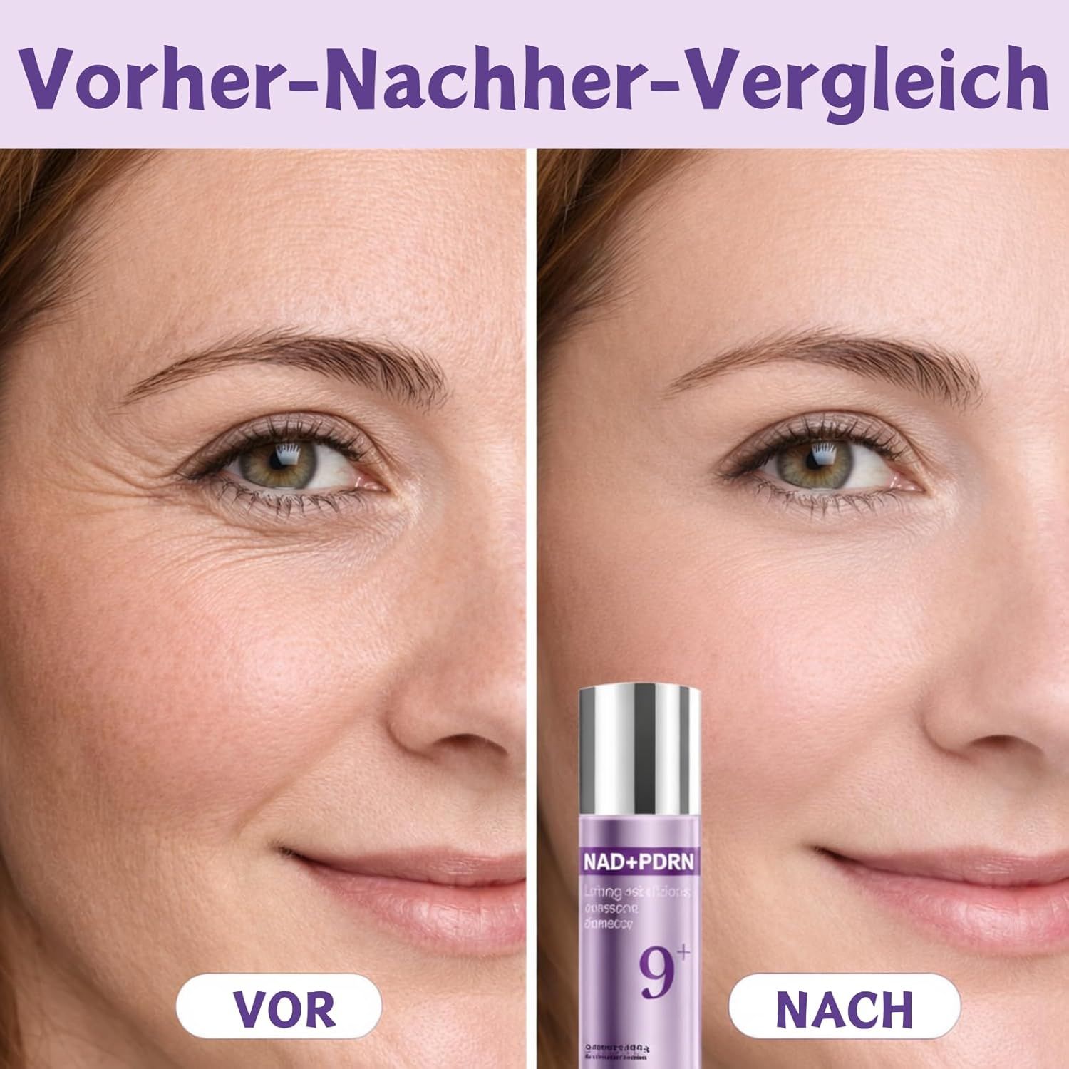 SUMMISHI NAD + PDRN Lifting Essence