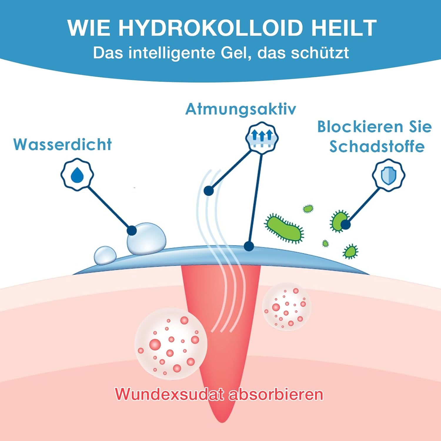 Diagramm: Wie Hydrokolloid heilt. Wasserdicht, atmungsaktiv, blockiert Schadstoffe. Absorbiert Wundexsudat. Darstellung einer Wunde mit Gel.