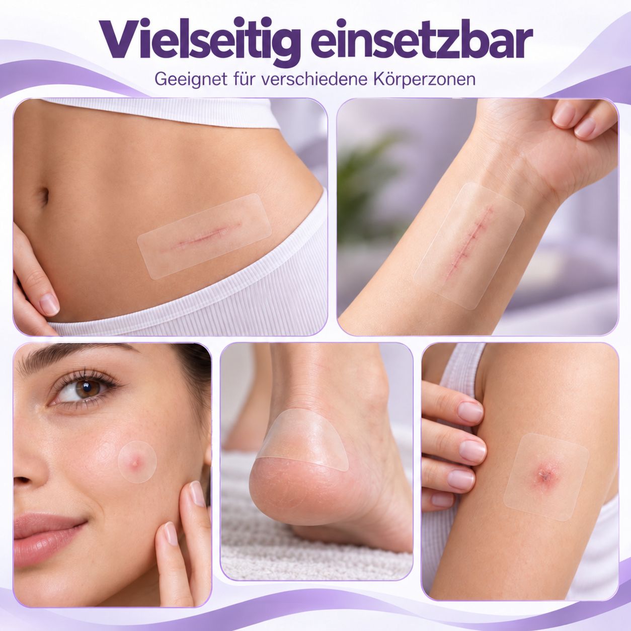 Anwendungsbeispiele: Bauch, Arm, Gesicht, Ferse, Schulter. Hydrokolloid Pflaster Rolle.