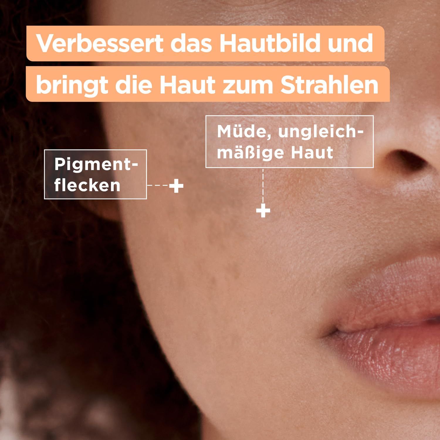 Nahaufnahme von Haut. Pigmentflecken und ungleichmäßige Haut. Produkt verbessert das Hautbild.