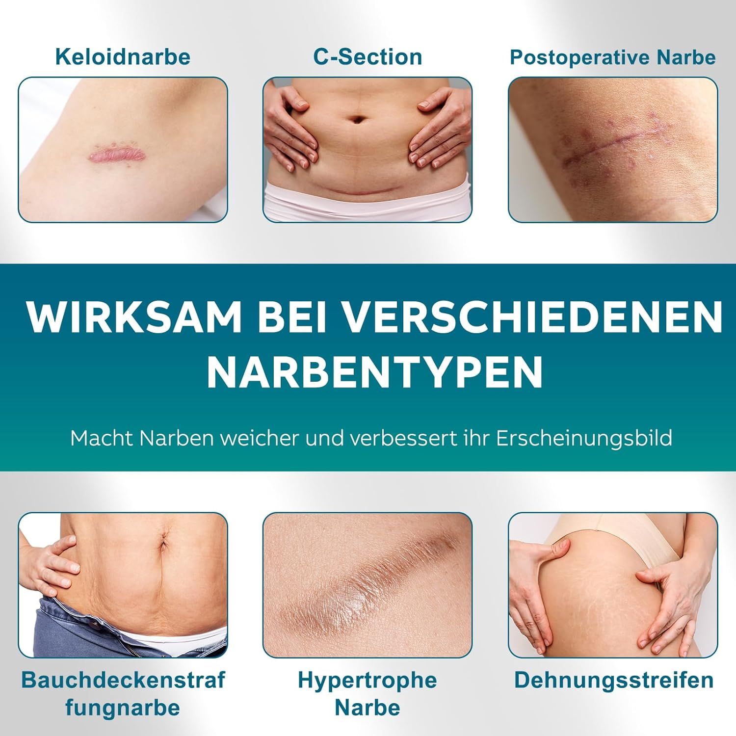 UNIEDI Narbenpflaster V2601-0007