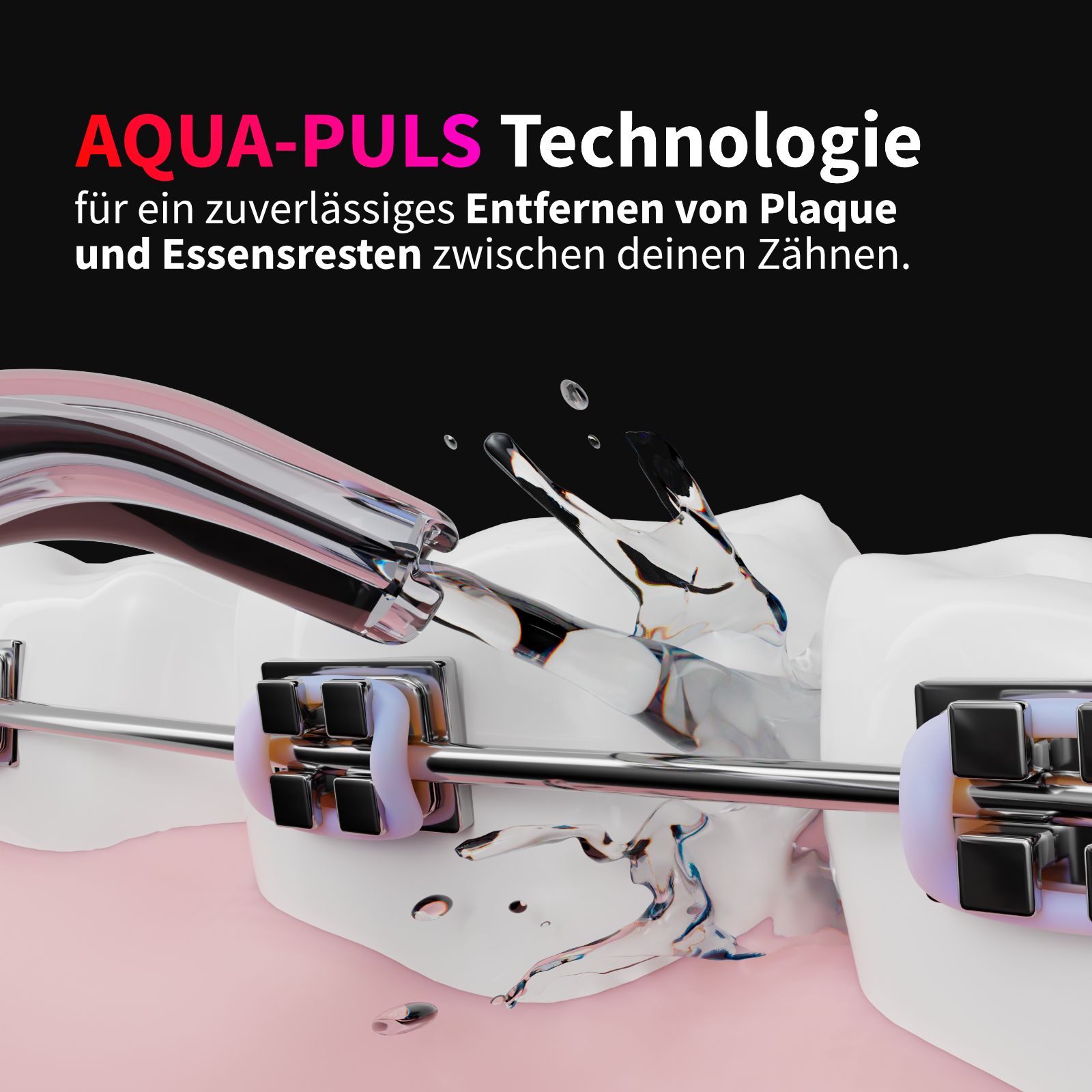 Zahnmodell mit Zahnspange. Wasserstrahl reinigt Zähne. Text: AQUA-PULS Technologie für zuverlässige Entfernung von Plaque.