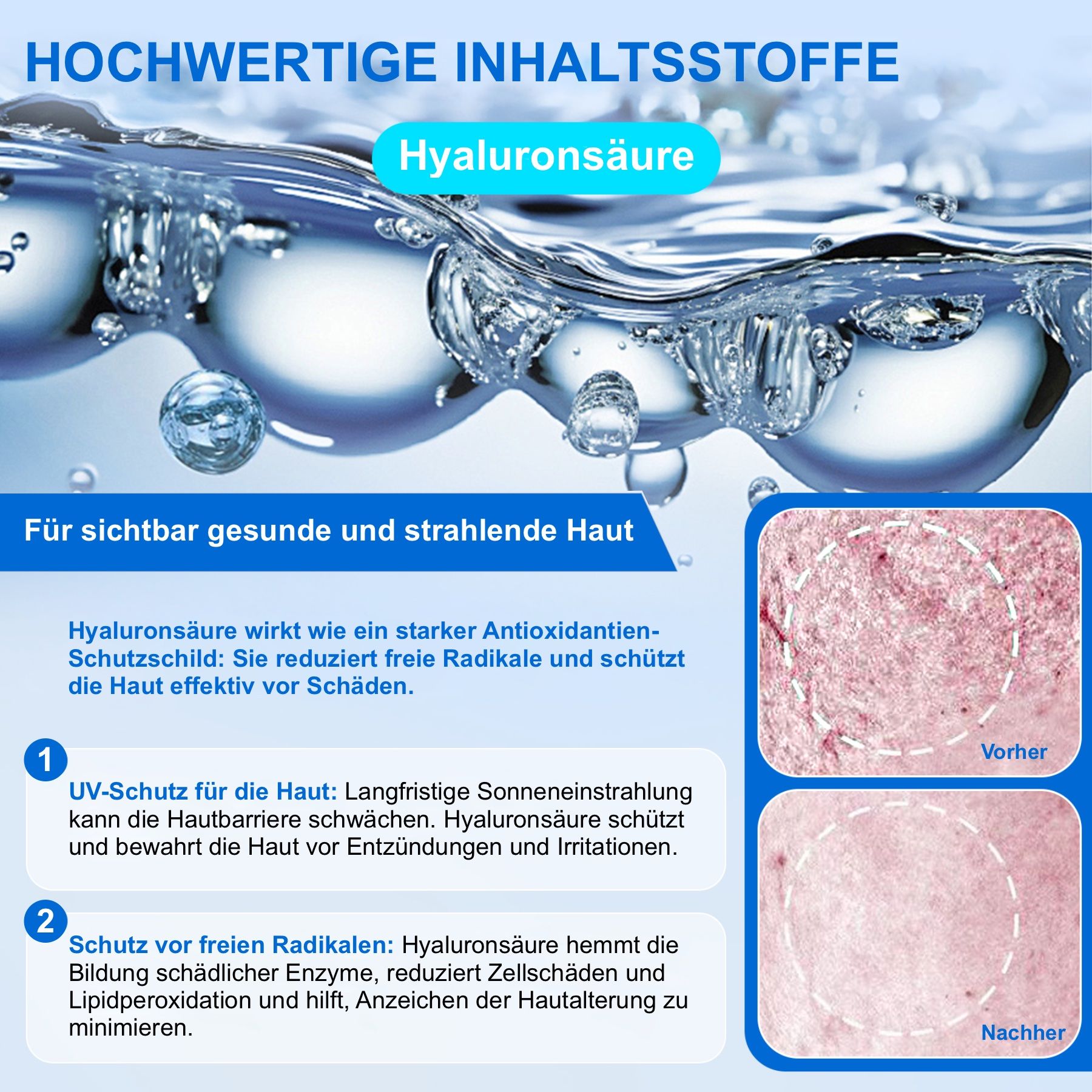 Diagramm mit Hyaluronsäure und Haut. Text: UV-Schutz, Schutz vor freien Radikalen. Vorher-Nachher-Bilder.