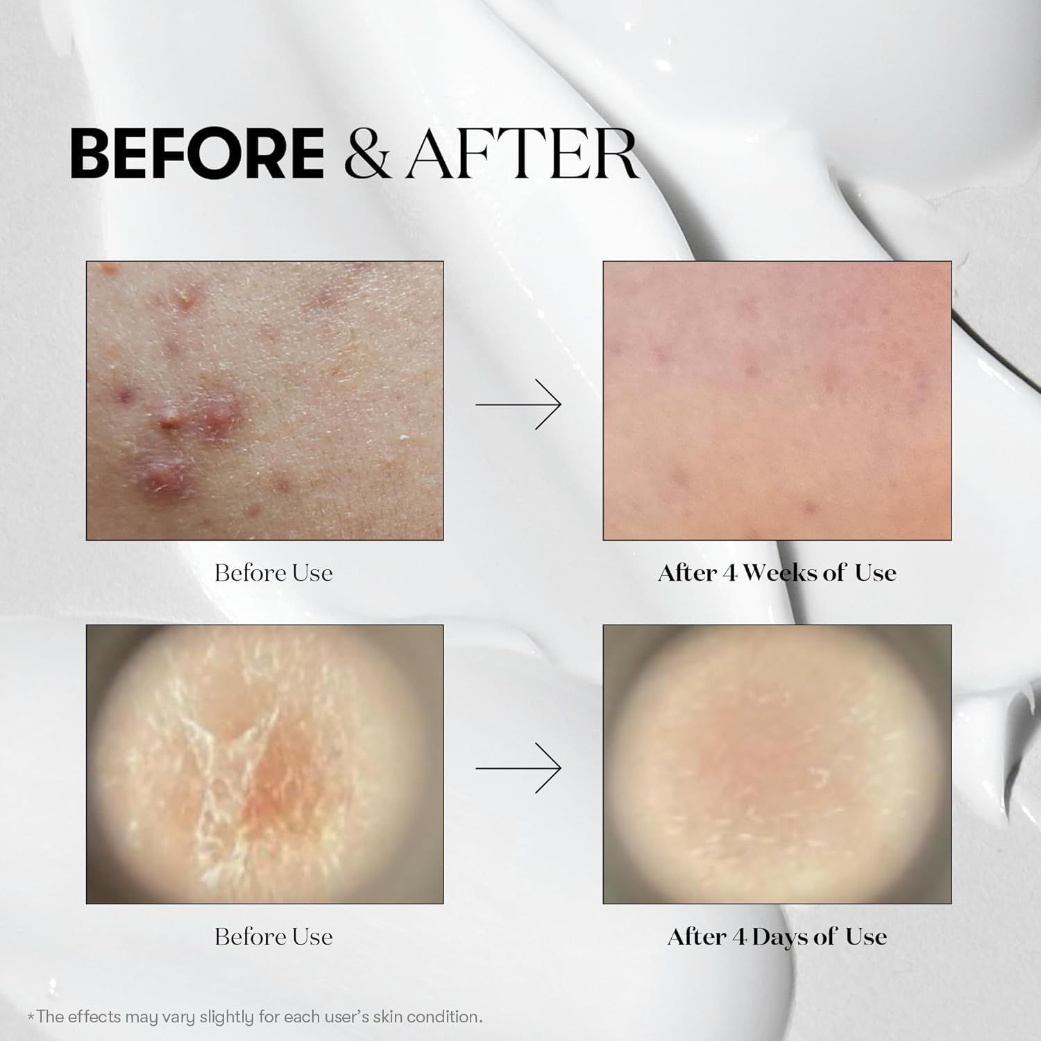 VT COSMETICS 300 Reedle Shot