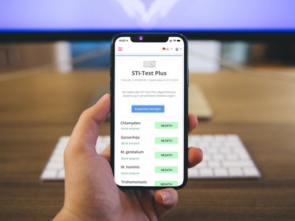 Smartphone mit Testergebnissen. STI-Test Plus. Ergebnisse für Chlamydien, Gonorrhöe, etc. Negativ angezeigt.