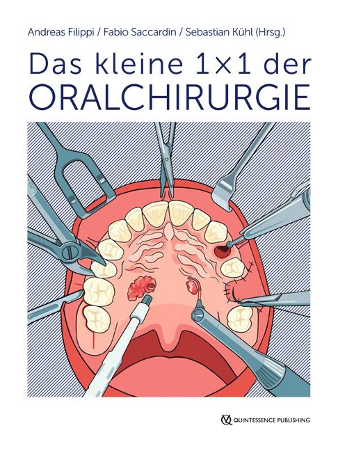 Das kleine 1 x 1 der Oralchirurgie