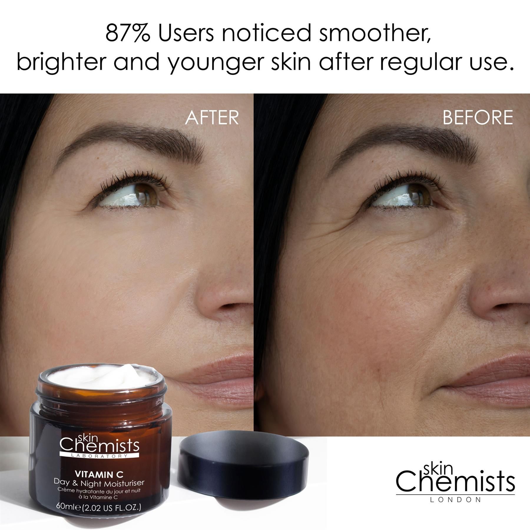 Vorher/Nachher-Vergleich der Haut mit SkinChemists Vitamin C Feuchtigkeitscreme.