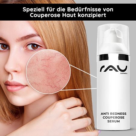 RAU Cosmetics Anti Redness Couperose Serum Anti Rötungen, Rosacea & Besenreiser mit Rosskastanie