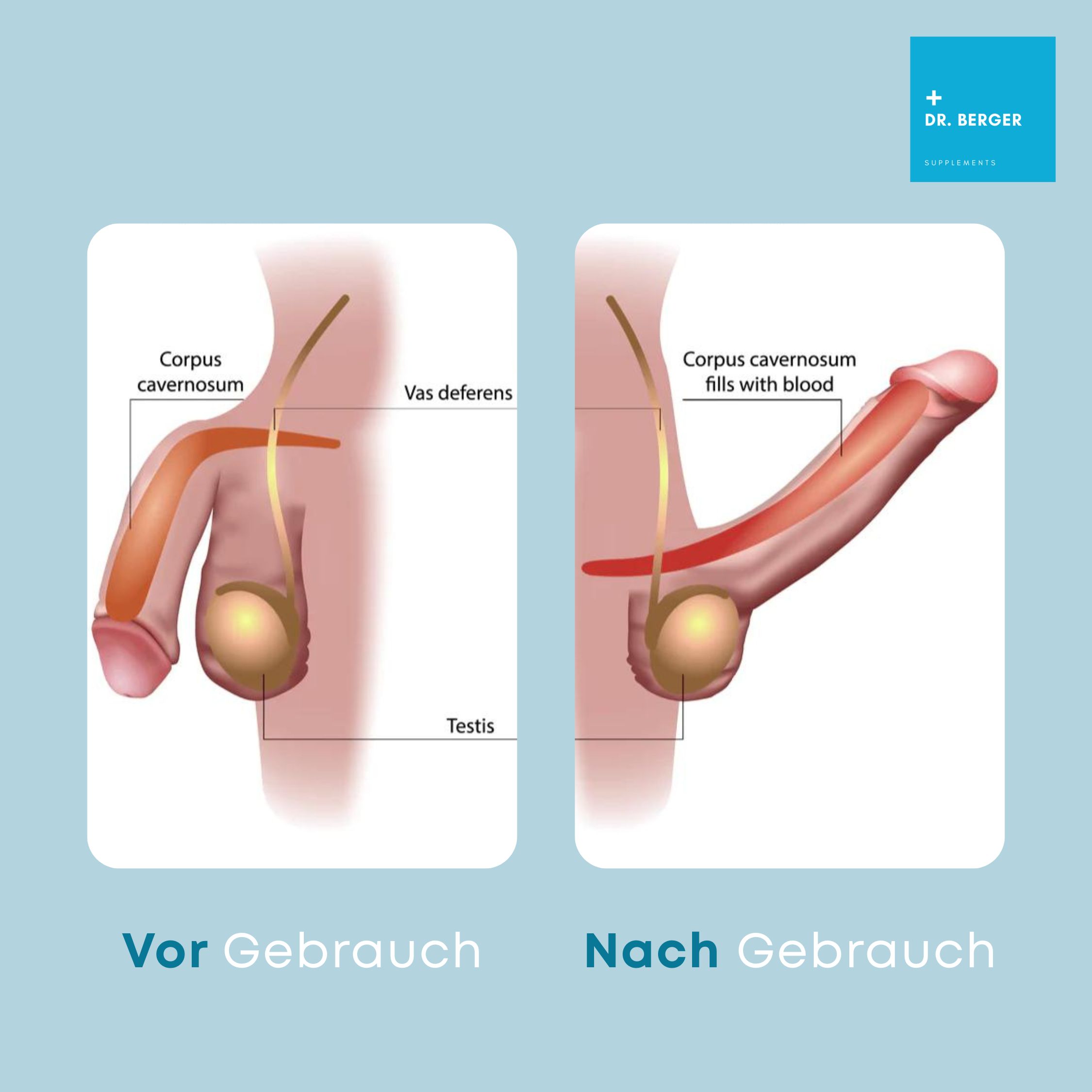 Zwei Diagramme. Vor und nach Gebrauch. Darstellung des Penis. Beschriftung: Corpus cavernosum, Testis.