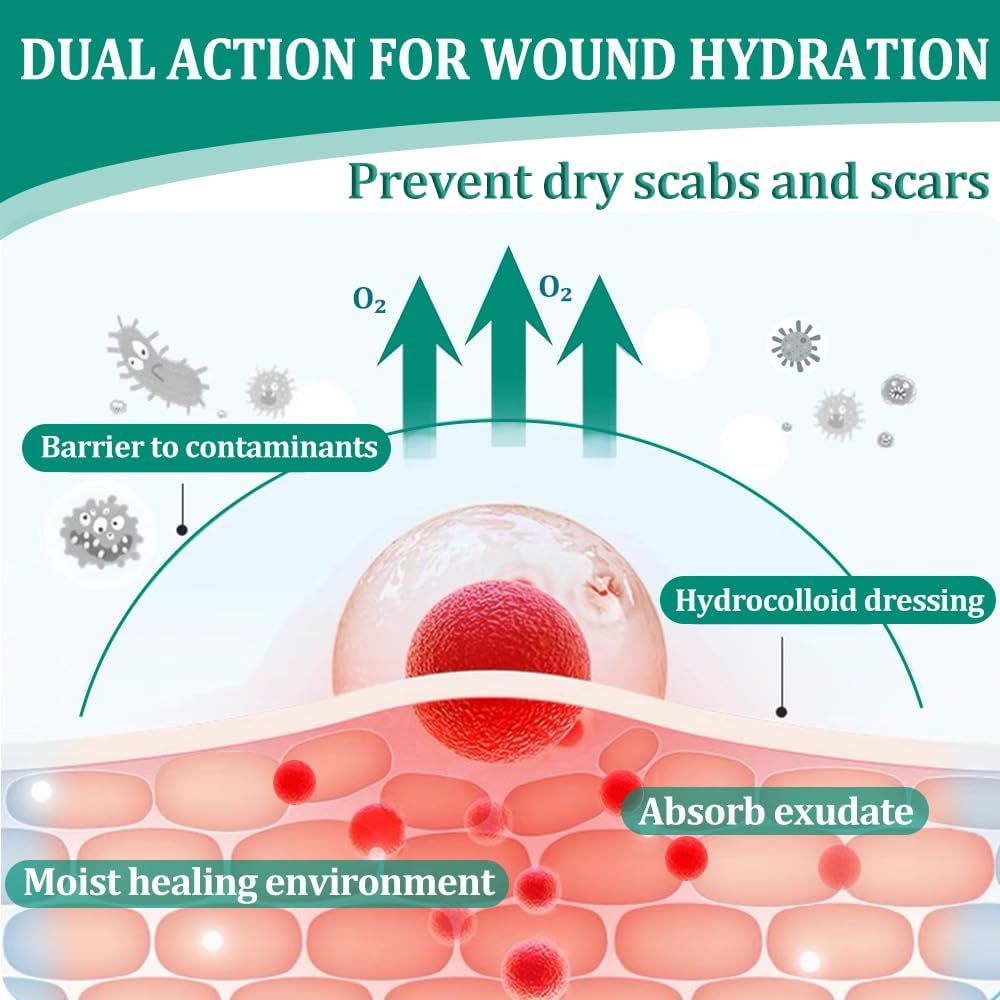 Diagramm: Hydrokolloid-Pflaster. Zeigt Barriere gegen Verunreinigungen, feuchte Heilungsumgebung, Absorption von Exsudat, verhindert trockene Krusten und Narben.