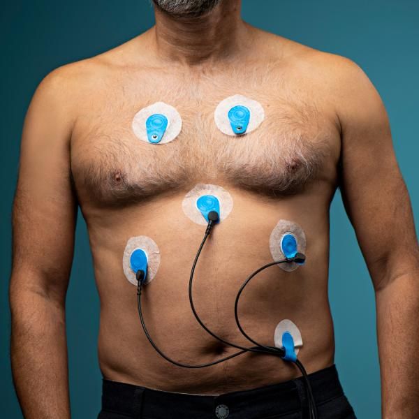 Brust eines Mannes mit sechs EKG-Elektroden. Blaue Sensoren mit Kabeln auf der Haut befestigt.