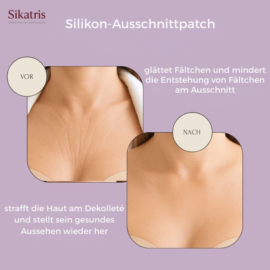 Vergleichsfoto: Dekolleté vor und nach der Anwendung. Text: Sikatris, glättet Fältchen, strafft die Haut, stellt das Aussehen wieder her.