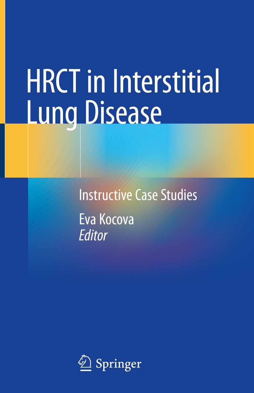 Buchcover: HRCT in Interstitial Lung Disease. Autorin: Eva Kocova. Verlag: Springer. Blauer Hintergrund mit gelben Akzenten.