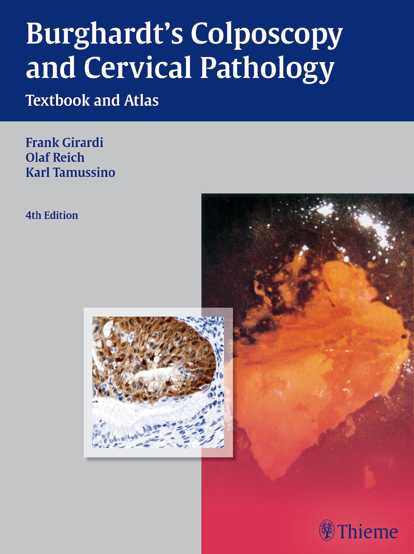 Buchcover: Burghardt's Colposcopy and Cervical Pathology. Autoren: Girardi, Reich, Tamussino. 4. Auflage. Verlag Thieme. Abbildung von Gewebe.