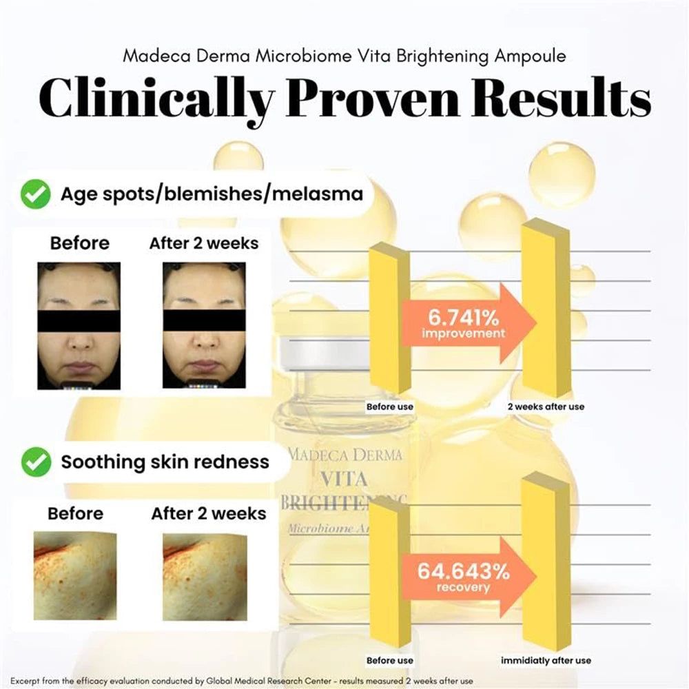 Klinisch bewiesene Ergebnisse für MADECA DERMA Vita Brightening Ampoule: Vorher/Nachher-Bilder und Verbesserungsstatistiken.