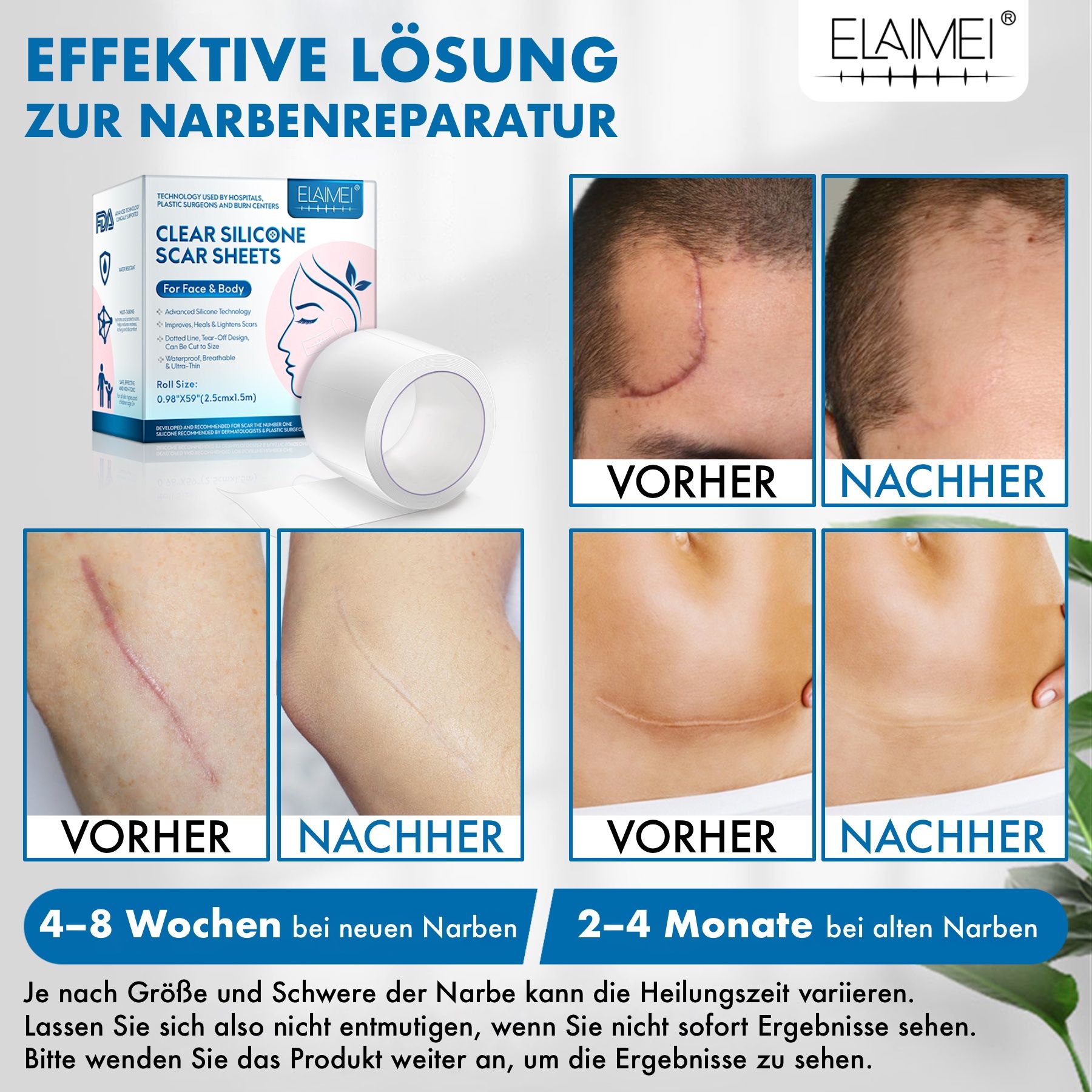 Vorher-Nachher-Bilder von Narben. ELAIMEI Clear Silicone Scar Sheets. Text: Effektive Lösung zur Narbenreparatur. 4-8 Wochen, 2-4 Monate.