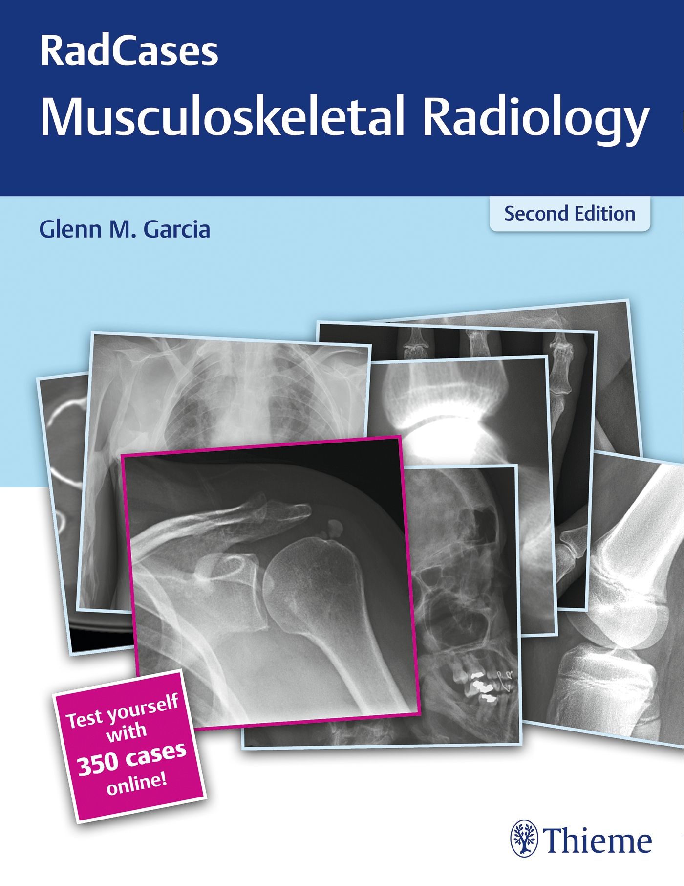Buchcover von RadCases Musculoskeletal Radiology. Titel, Autor und Röntgenbilder. Zweite Auflage. Thieme-Logo. Rosa Hinweis: 350 Fälle online testen.