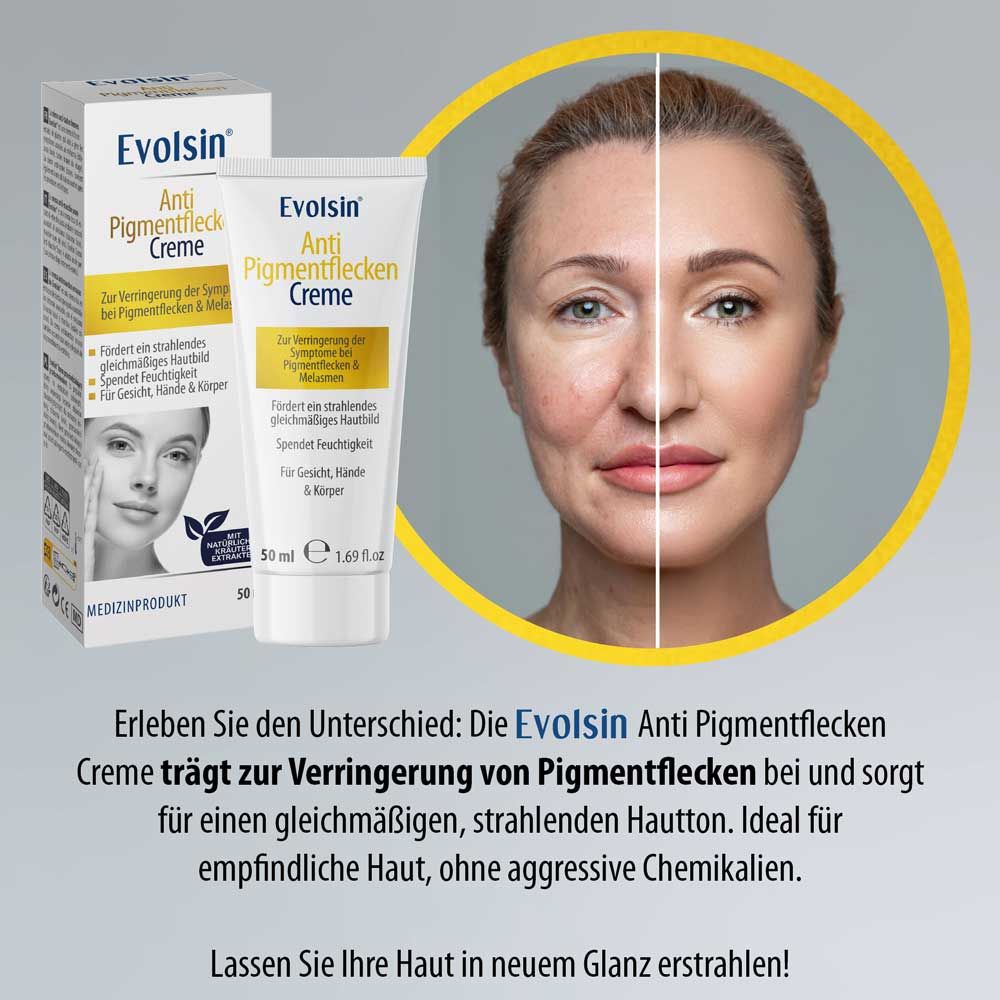 Vergleichsfoto: Gesicht mit Pigmentflecken und Gesicht ohne. EVOLSIN® Creme und Verpackung. Text.