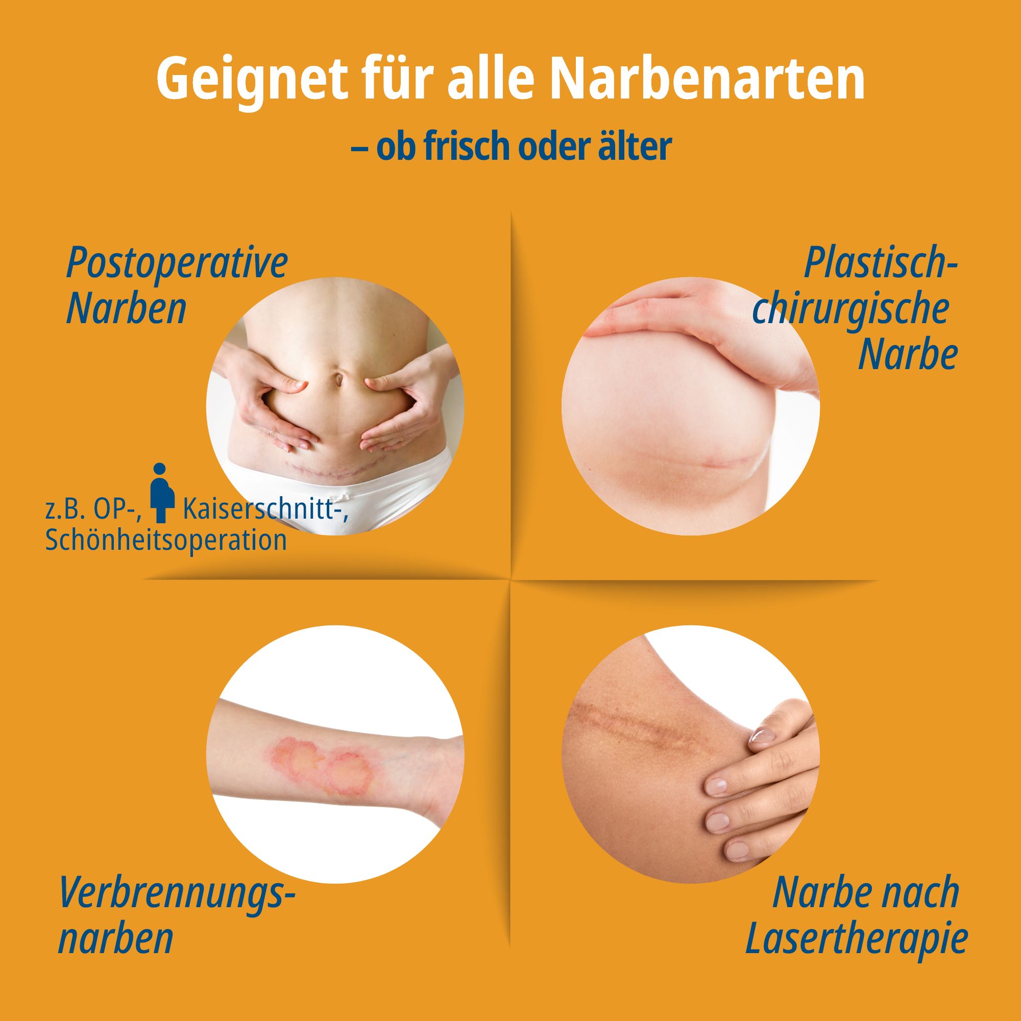 Evolsin® Narben Intensiv-Kur: Narbengel + Narbenpflaster - Reduziert die Sichtbarkeit von Narben