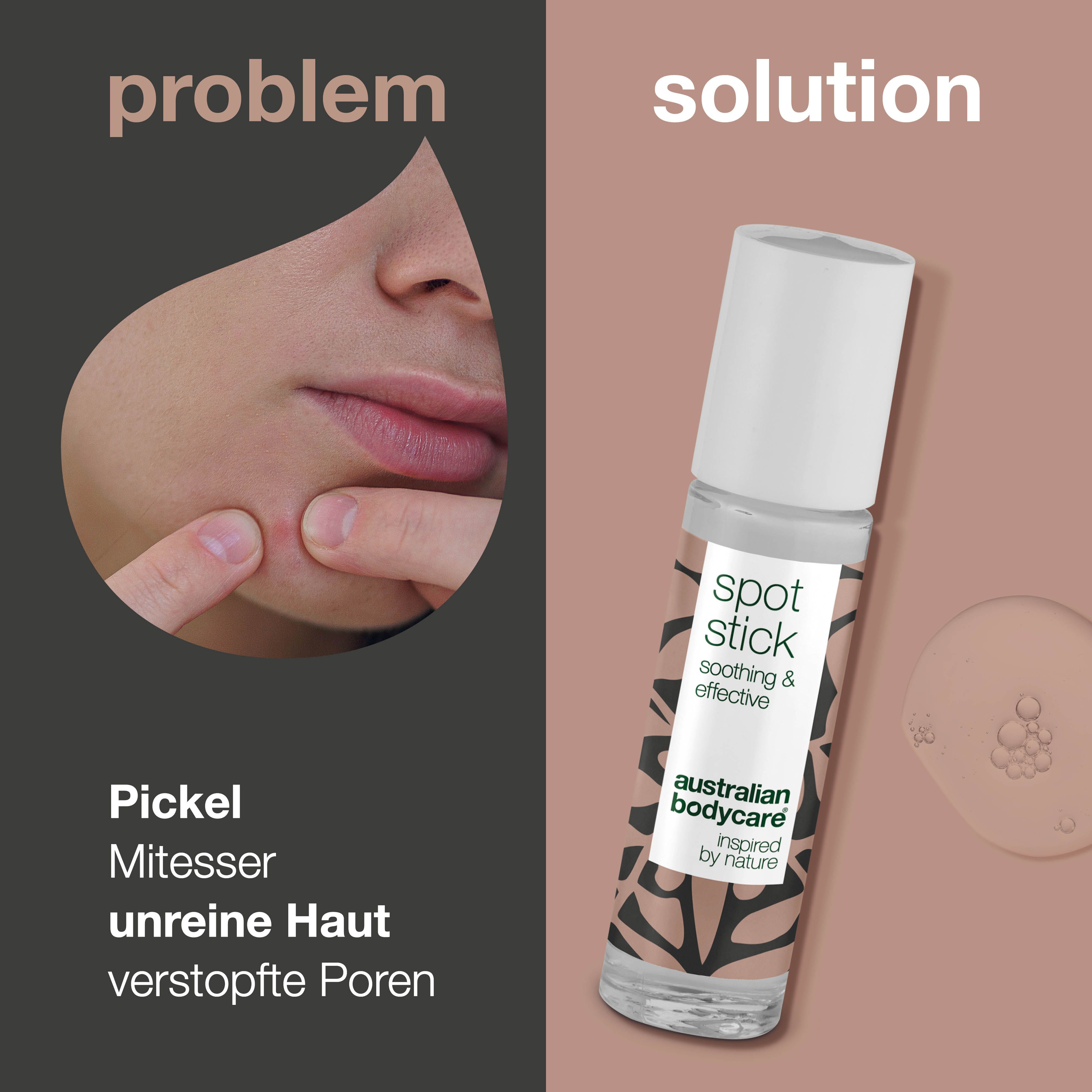 Produktabbildung mit Text. Links: Gesicht mit Pickel. Rechts: Spot Stick. Text: Pickel, Mitesser, unreine Haut, verstopfte Poren.