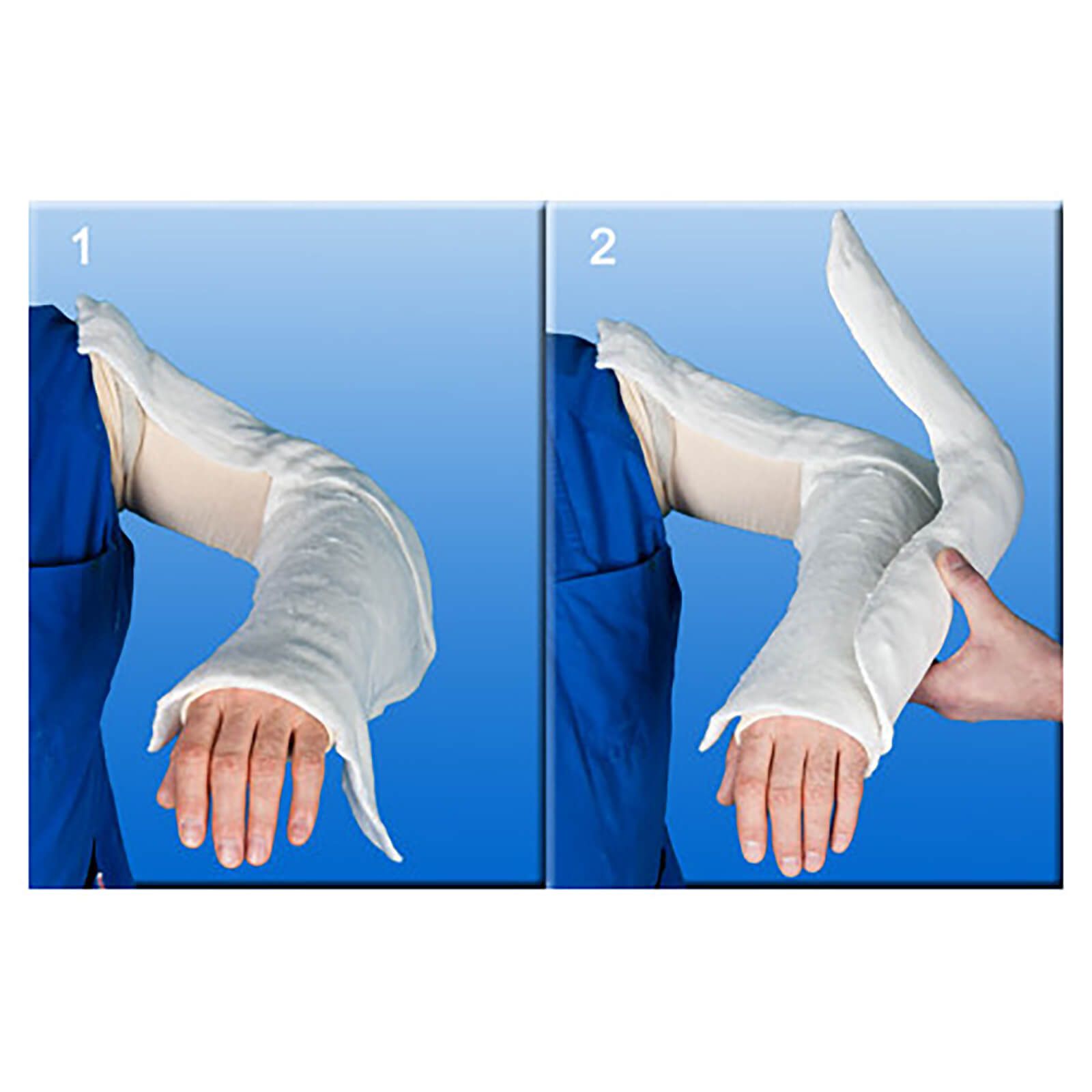 Zwei Bilder zeigen die Anwendung eines Gipsverbands am Arm. Auf blauem Hintergrund.