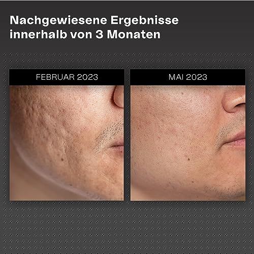 Vorher-Nachher-Vergleich. Haut mit Narben im Februar, verbesserte Haut im Mai. Grauer Hintergrund.