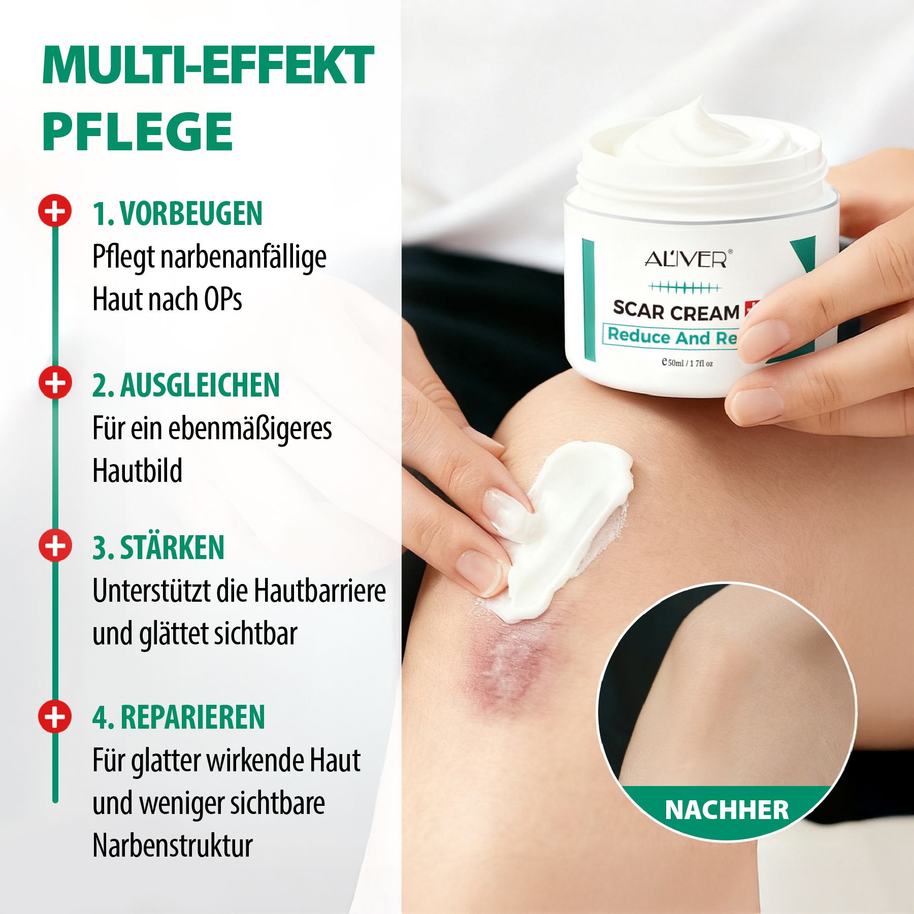 Creme auf Knie aufgetragen. ALIVER Scar Cream. Multi-Effekt Pflege. Text: Vorbeugen, Ausgleichen, Stärken, Reparieren. Vorher/Nachher-Bild.